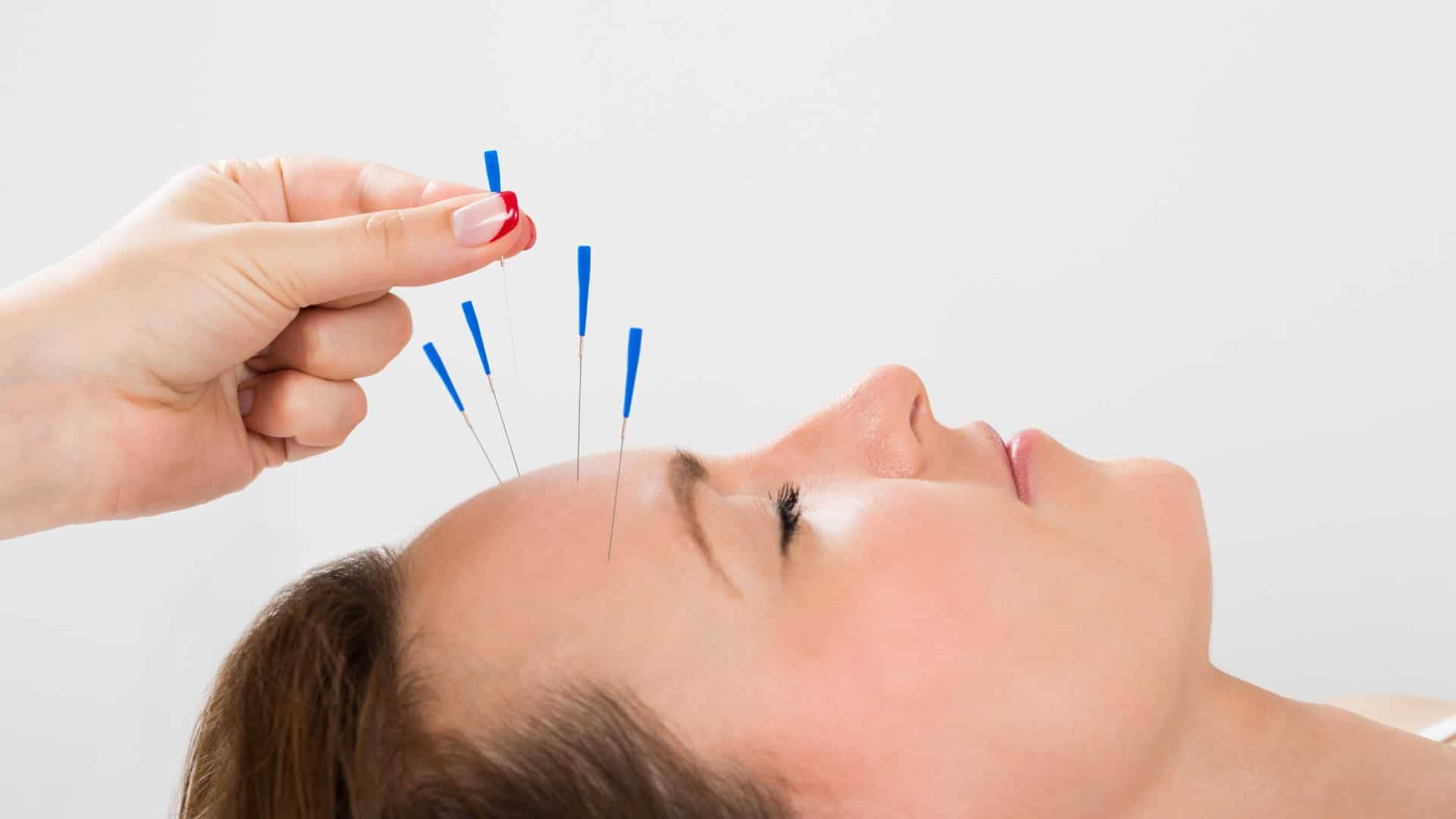 acupuncturist, forehead, thin needles, Full HD Desktop Wallpaper