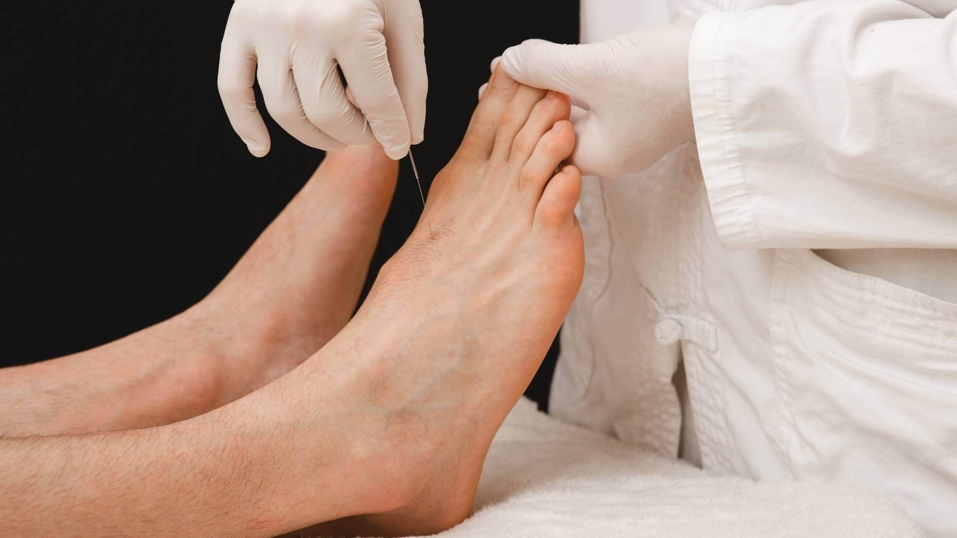 acupuncturist, feet, needle, Full HD Desktop Wallpaper