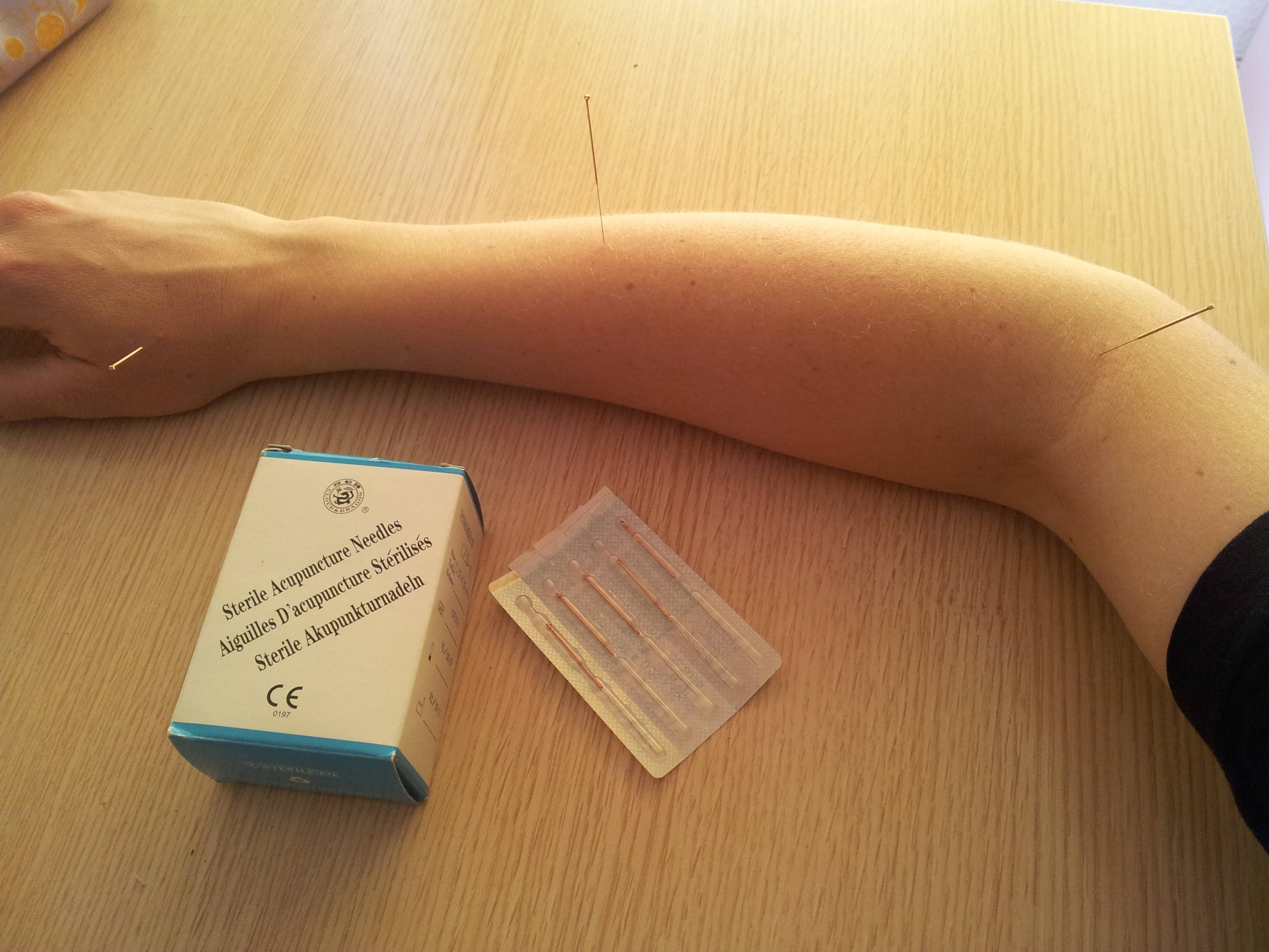 acupuncturist, arm, acupuncture needles, 2K Desktop Wallpaper