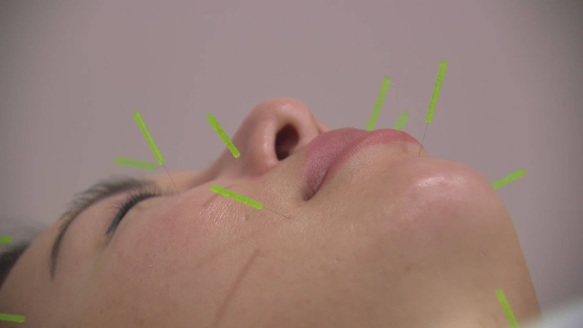 face acupuncturist therapy, bright green acupuncture needles, near the nose, Full HD Desktop Wallpaper