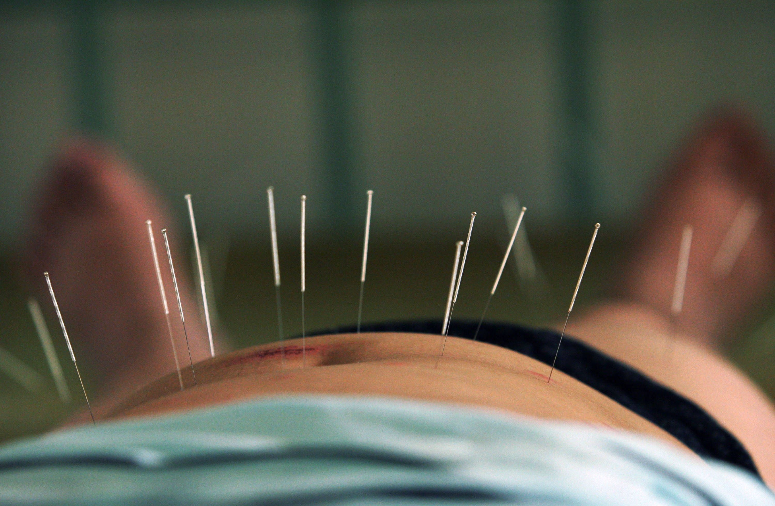 acupuncturist, alternative medicine, abdomen, 2K Desktop Wallpaper
