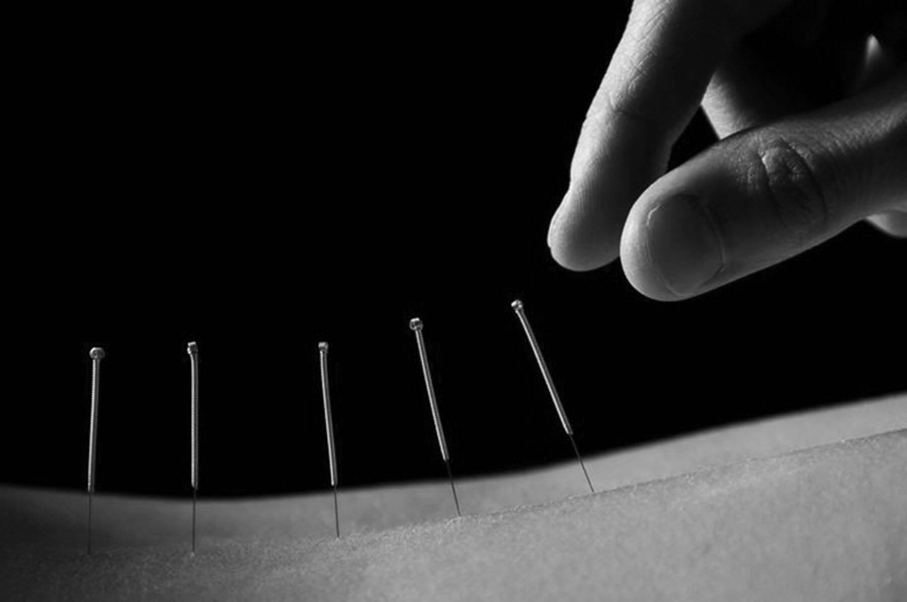 acupuncturist needles, black and white, close-up, HD Desktop Wallpaper