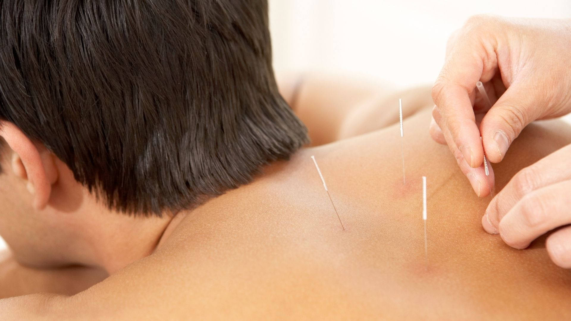 acupuncturist, acupuncture session, thin needles, Full HD Desktop Wallpaper