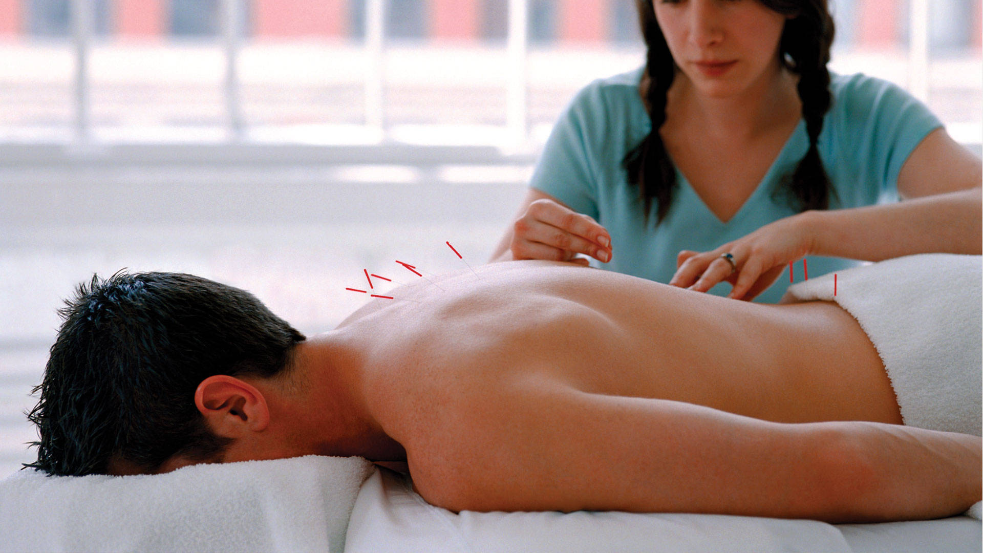 acupuncturist, back needle insertion, bare back, Full HD Desktop Wallpaper