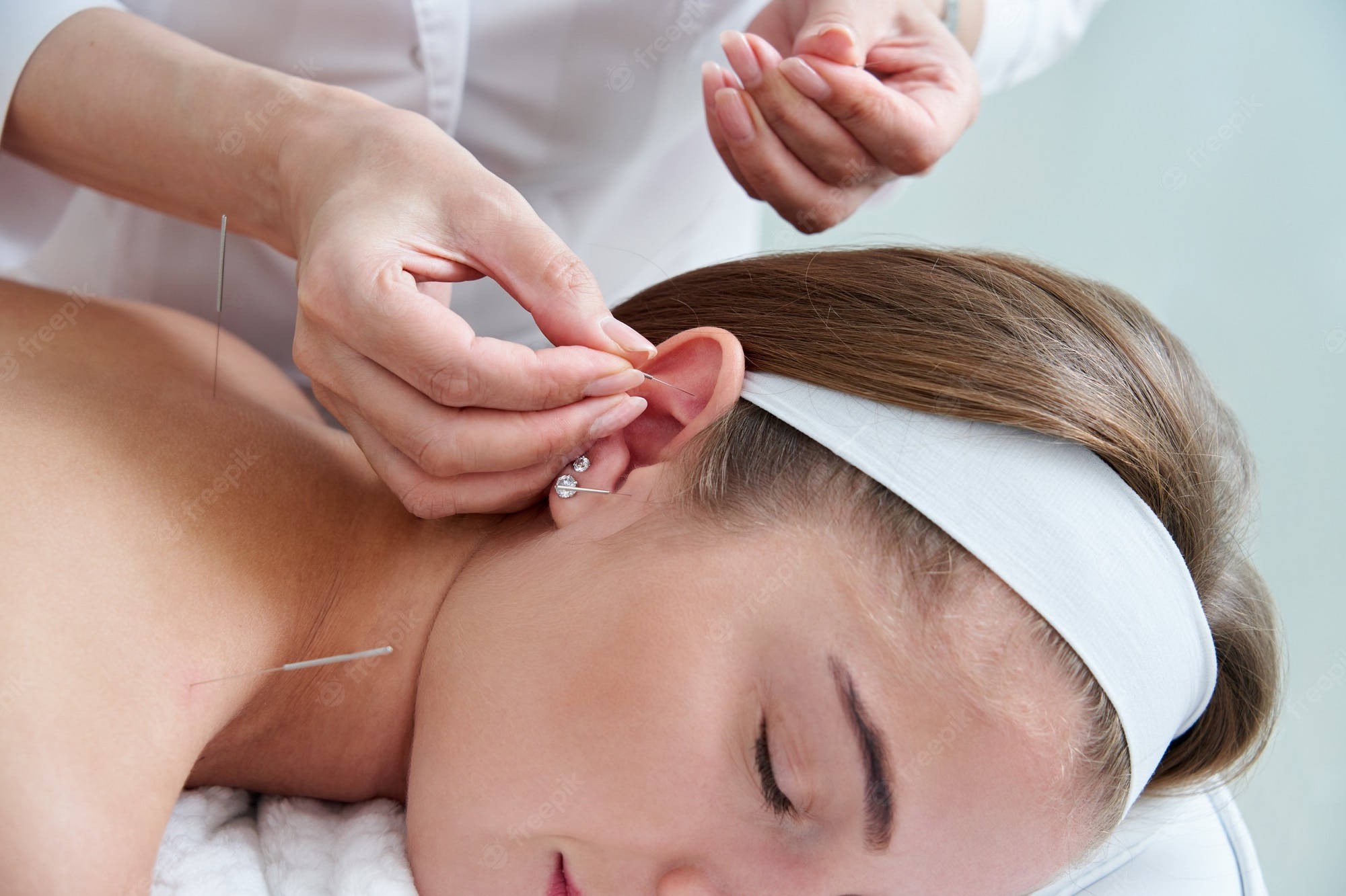 acupuncturist, ear needle treatment, thin needles, Full HD Desktop Wallpaper
