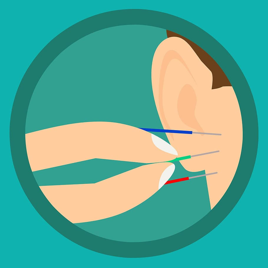 acupuncturist, ear needle treatment, three colored acupuncture needles, SD Desktop Wallpaper