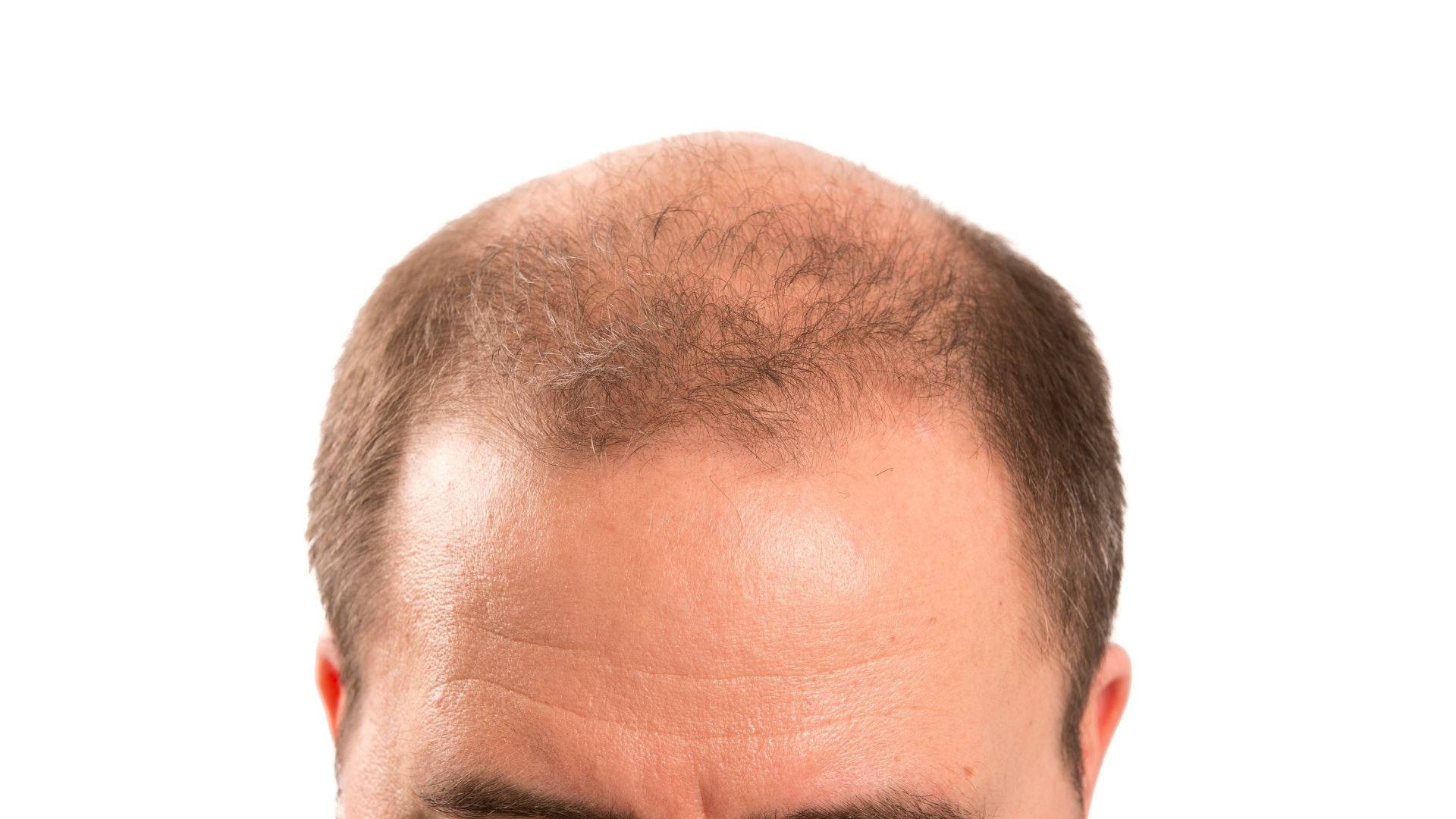 bald man, fading thin hair, receding hairline, Full HD Desktop Wallpaper