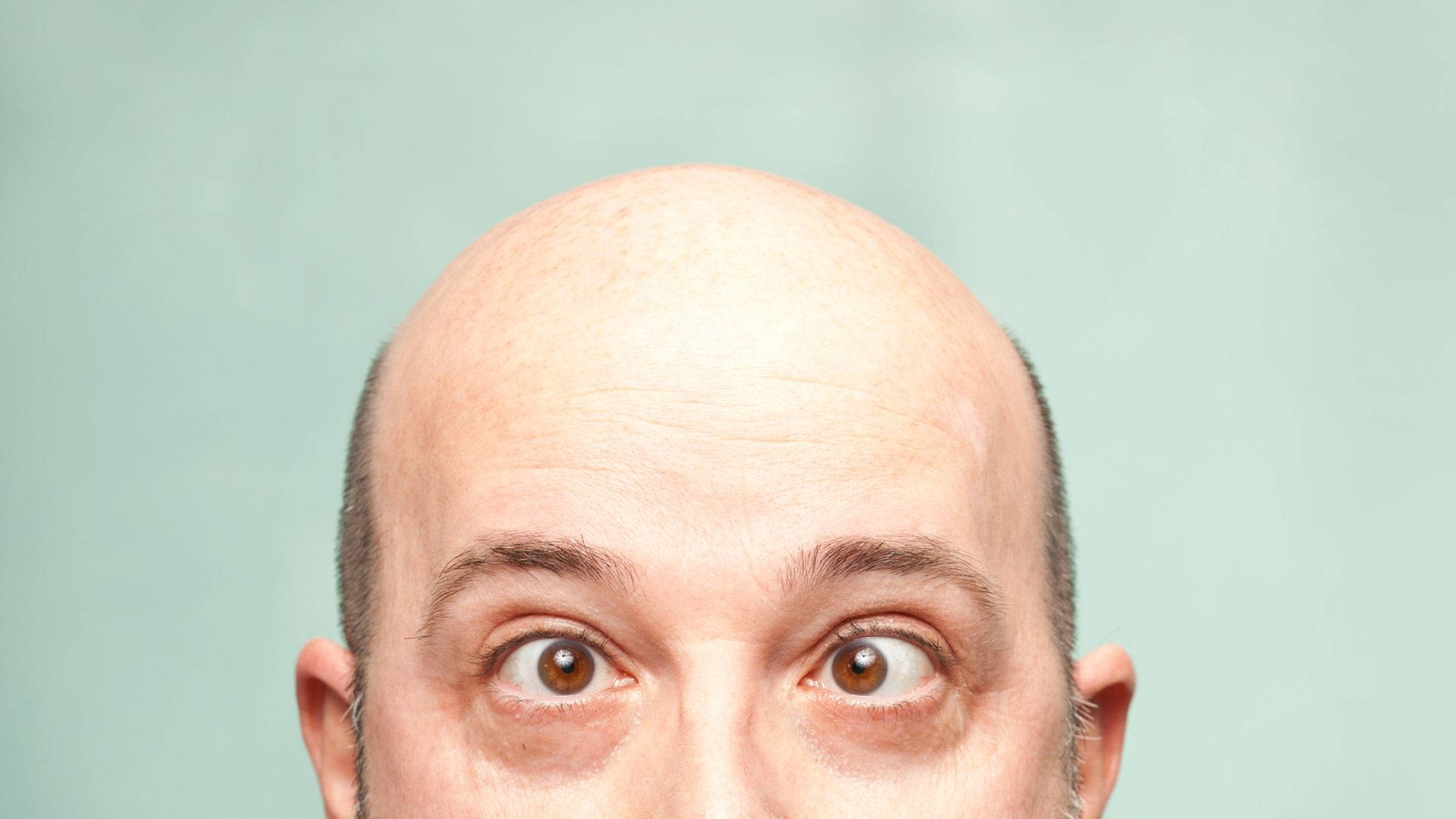 bald man, crossed eyes, wide brown eyes, Full HD Desktop Wallpaper
