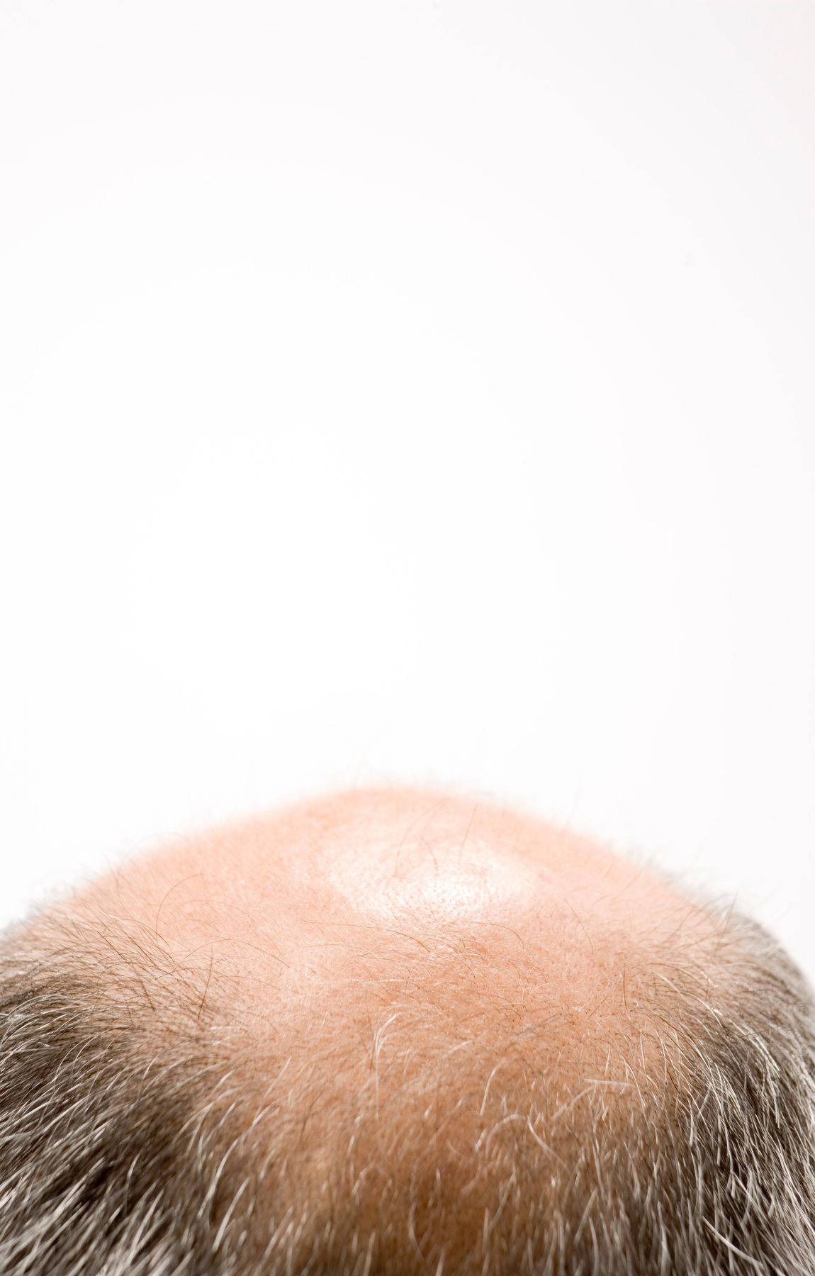 bald man, thinning white hair, balding scalp, HD Phone Wallpaper