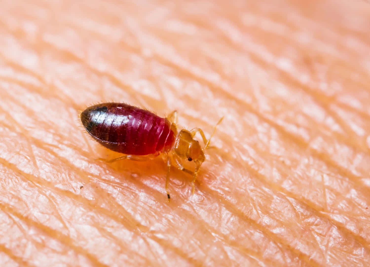Bed Bugon Skin.jpg, bed bug, human skin, HD Desktop Wallpaper