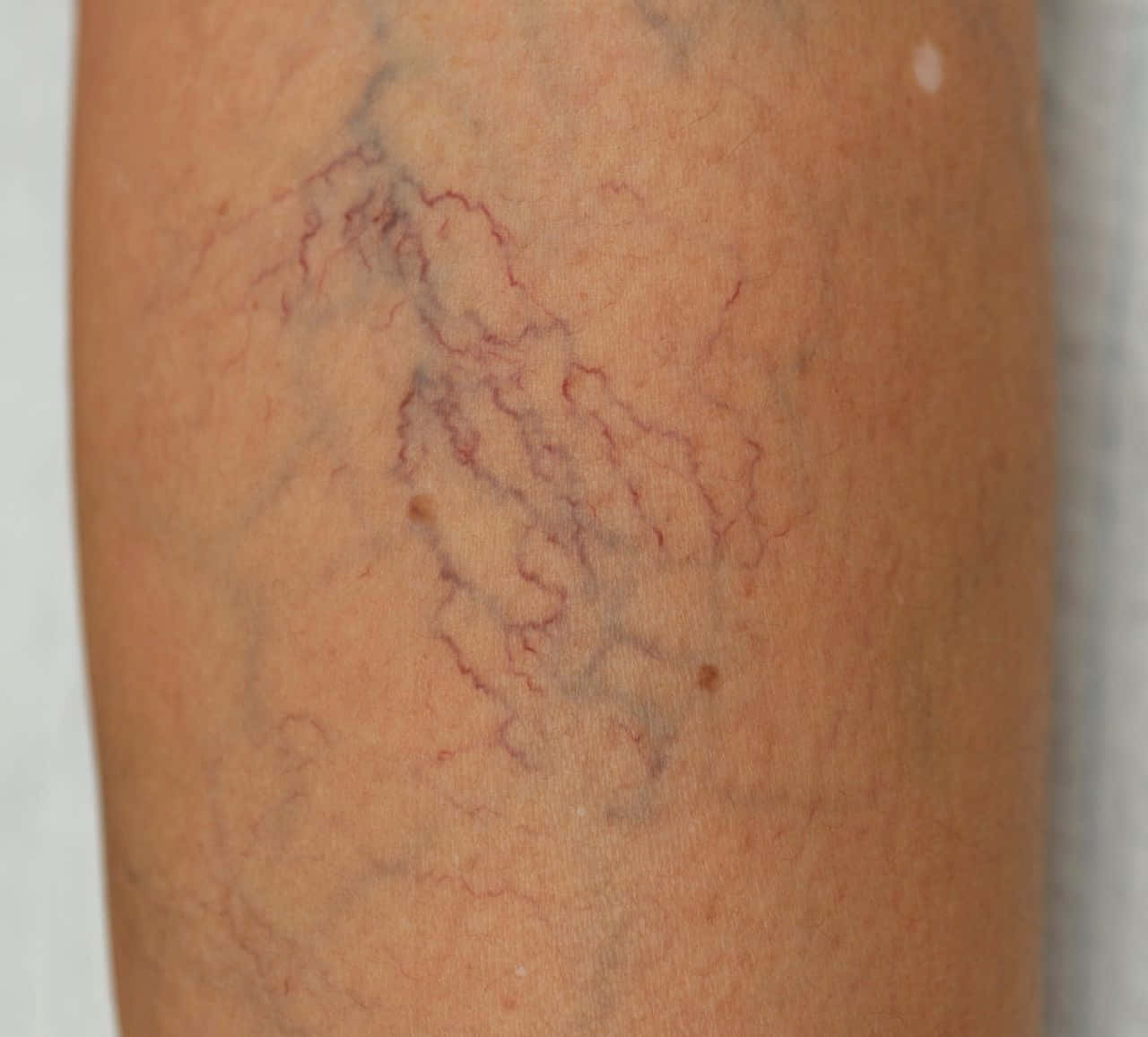 Blue Veins, red and blue veins, pale tone, HD Desktop Wallpaper