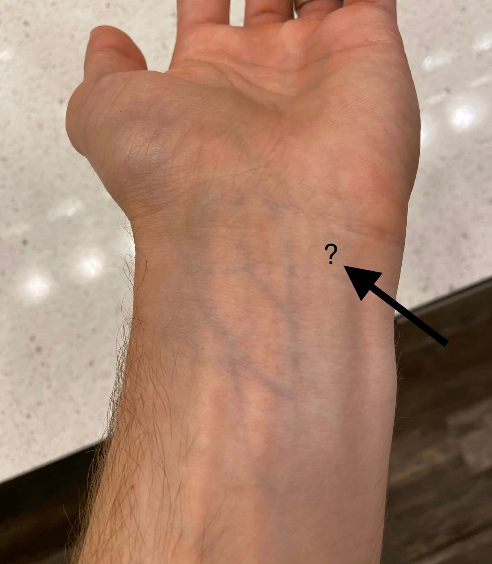 Blue Veins, human wrist, visible veins, Full HD Phone Wallpaper
