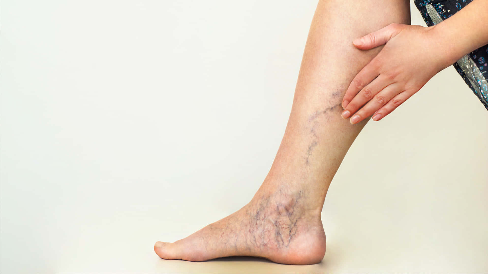 Blue Veins, 1920 x 1080, varicose veins, Full HD Desktop Wallpaper