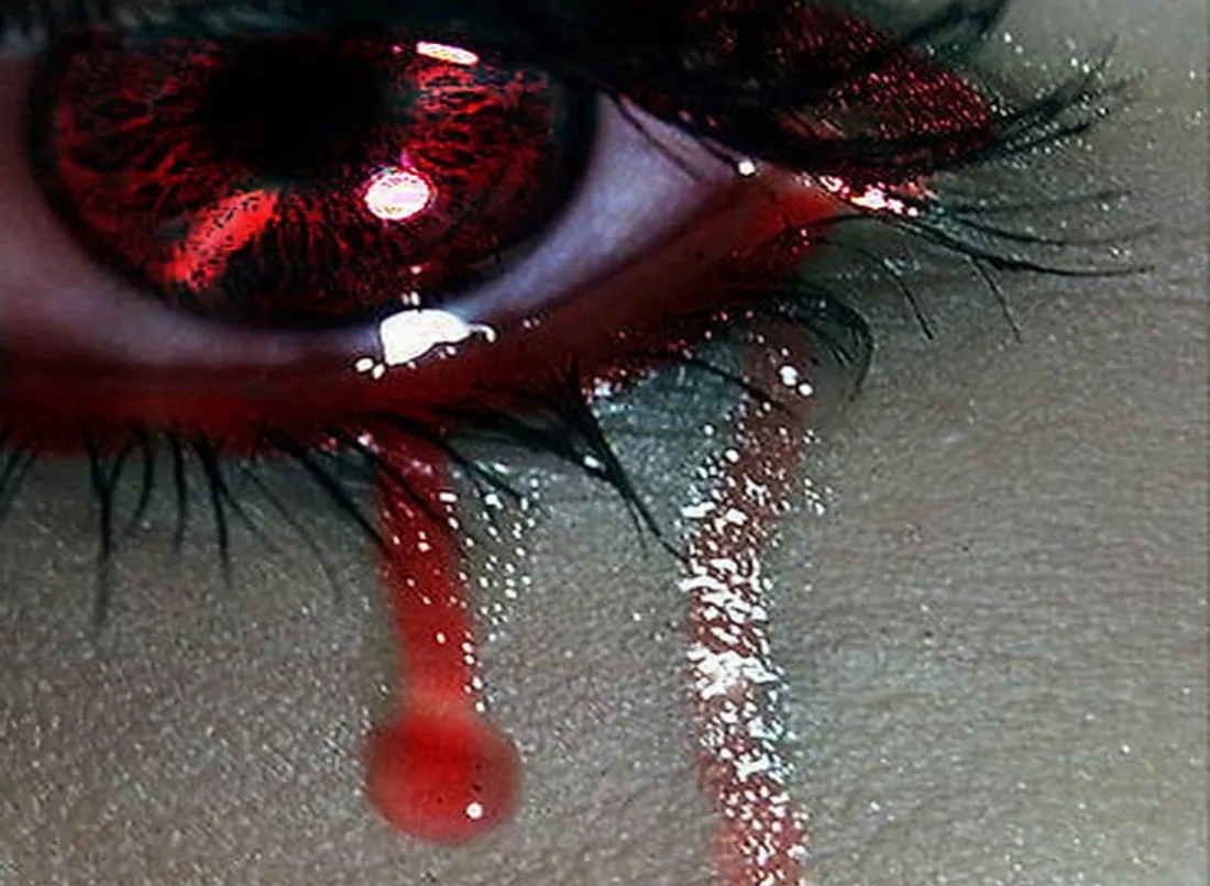Broken Heart