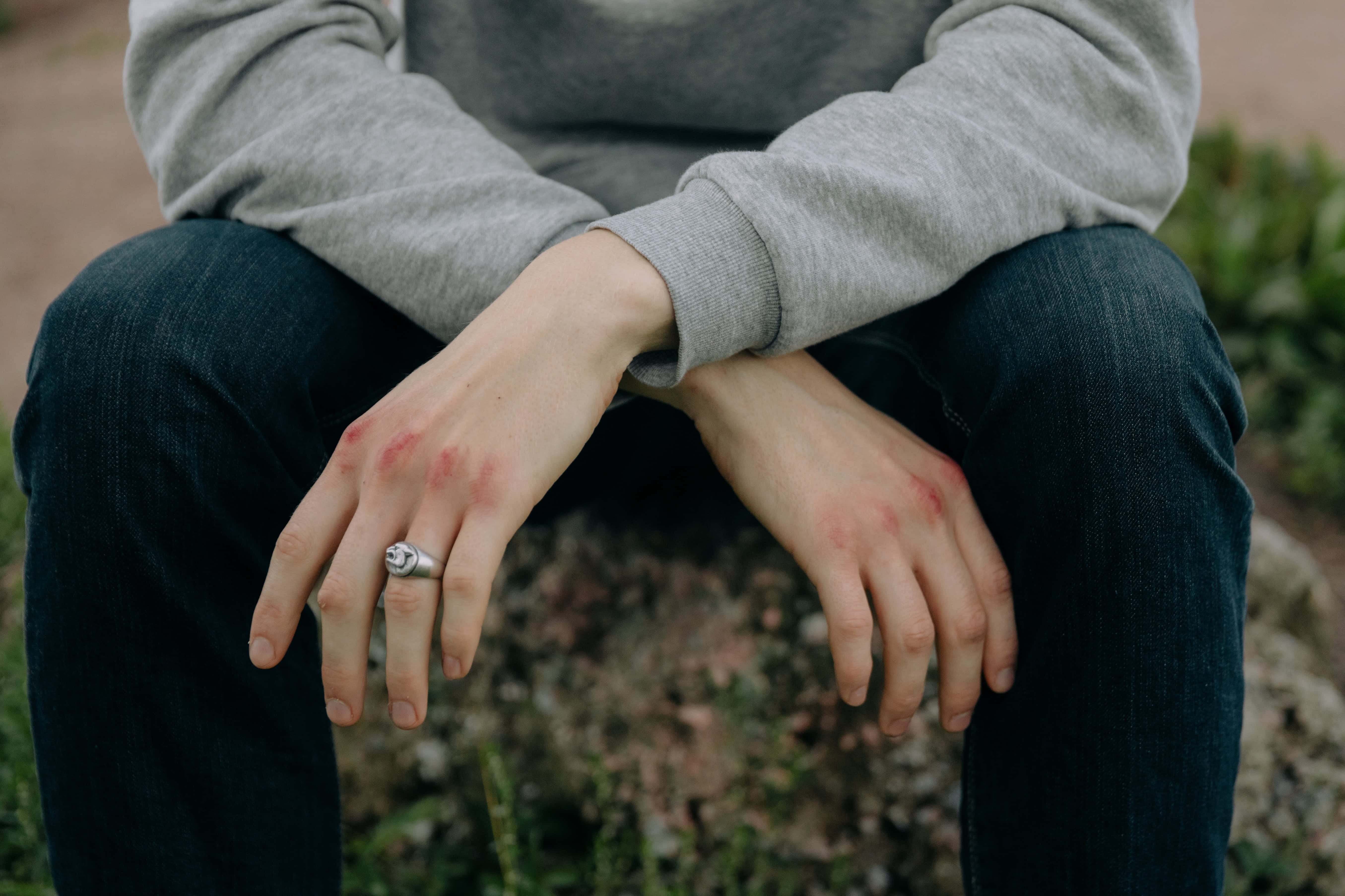 bruised knuckles, cross-legged, outdoors, 5K Desktop Wallpaper
