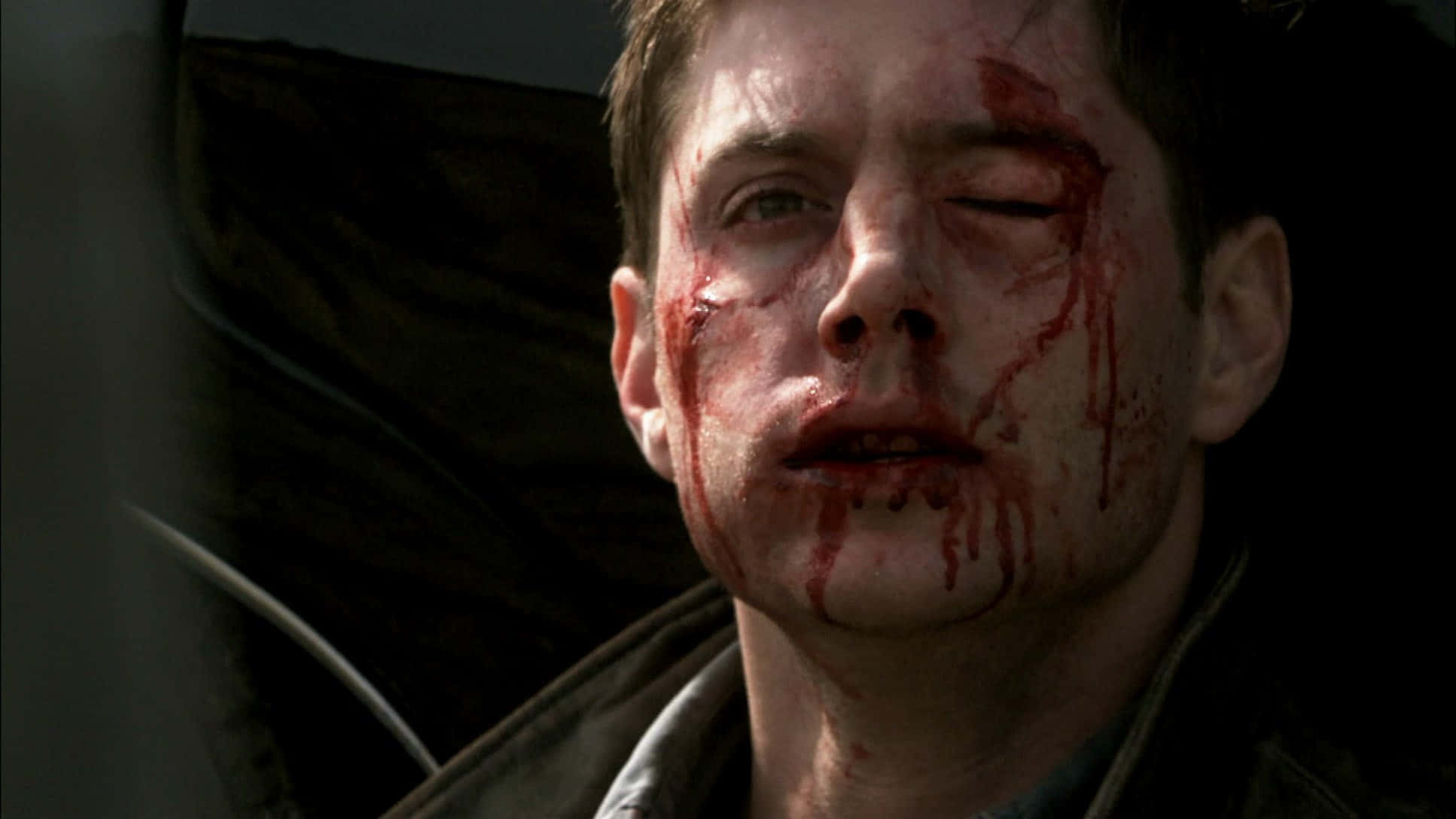 bruised and bloody man, blood streaking his face, one eye closed, Full HD Desktop Wallpaper