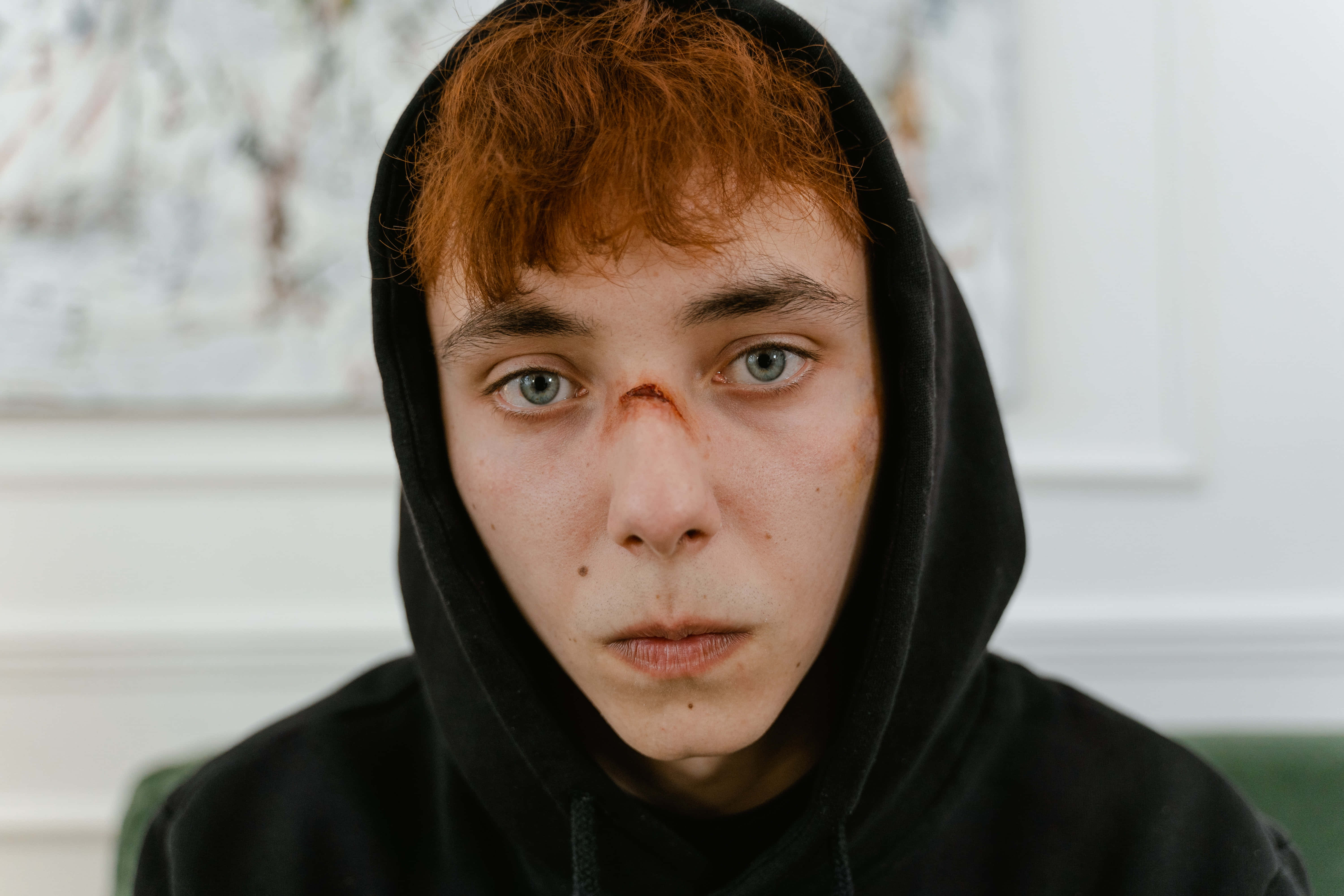redhead, black hoodie, small cut above nose, 5K Desktop Wallpaper