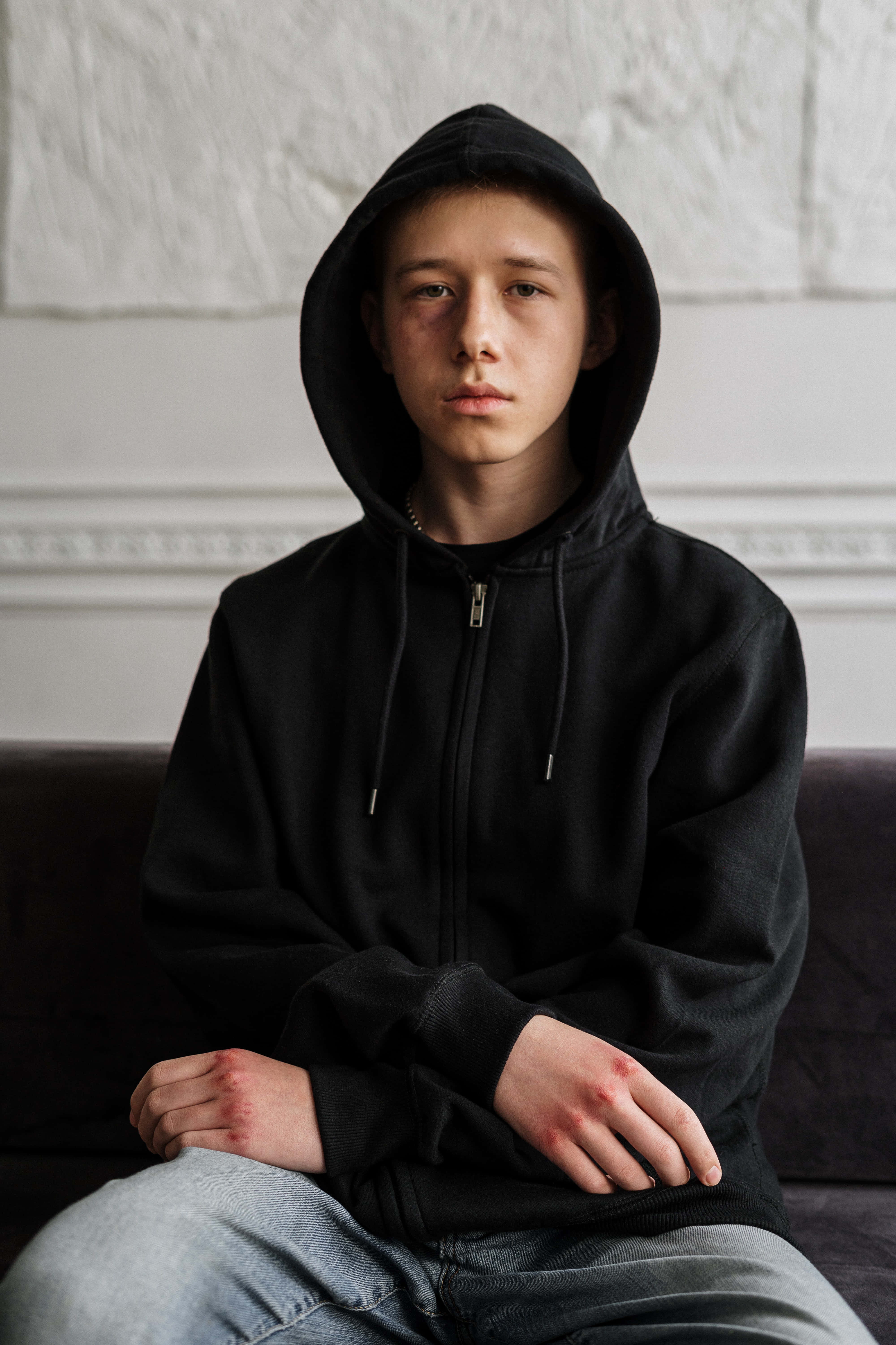 bruised boy, hoodie, black hoodie, 5K Phone Wallpaper