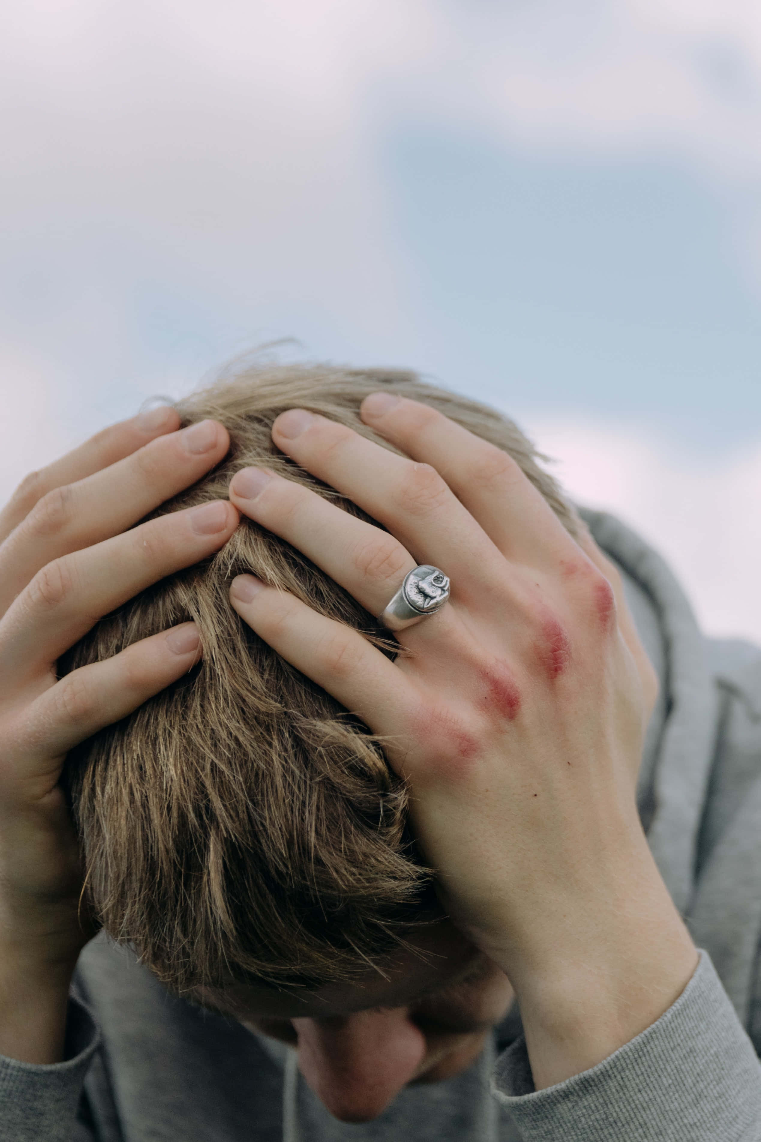 bruised knuckles, ring, hands clasped over head, 2K Phone Wallpaper
