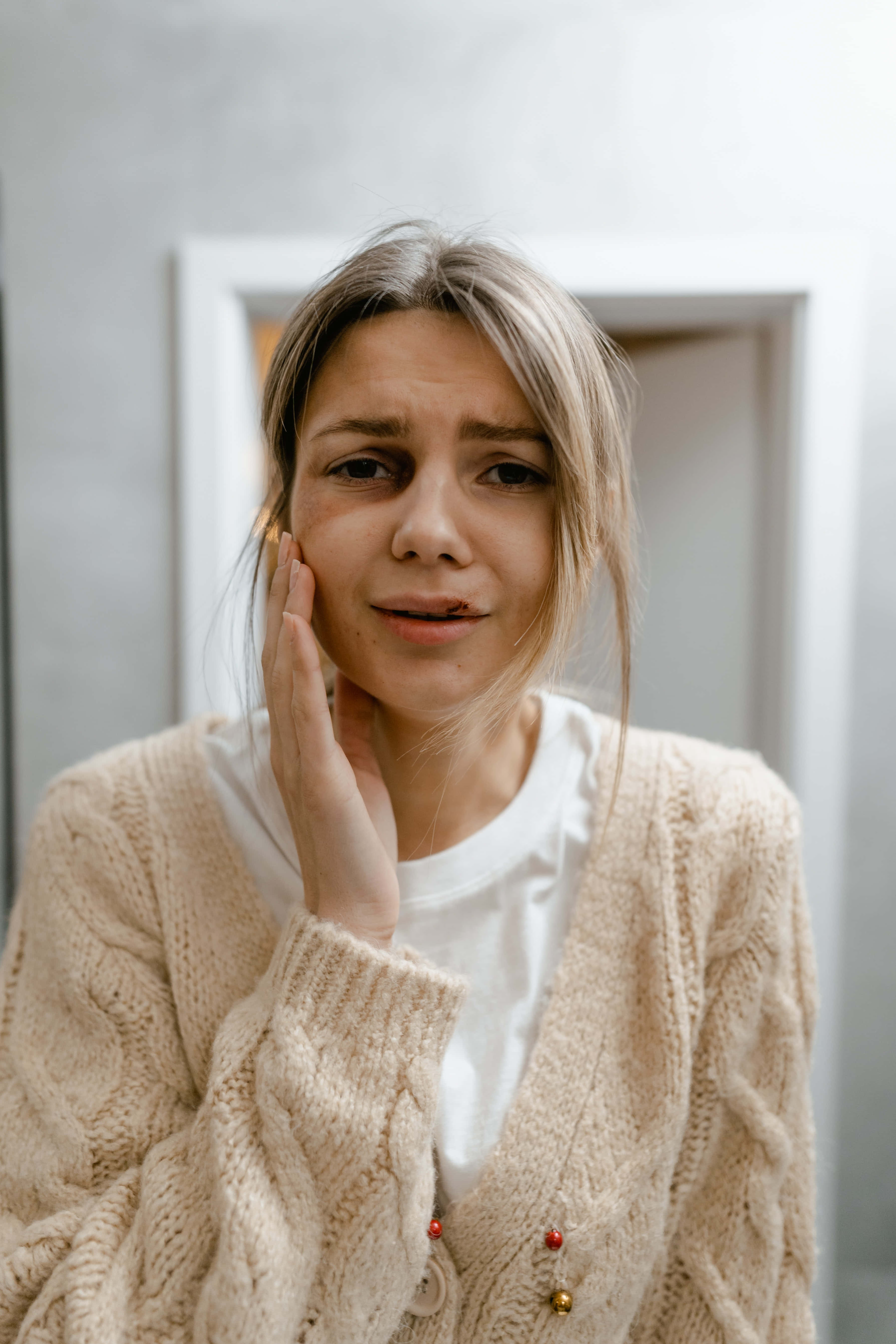 bruised girl, beige knit cardigan, pained expression, 5K Phone Wallpaper