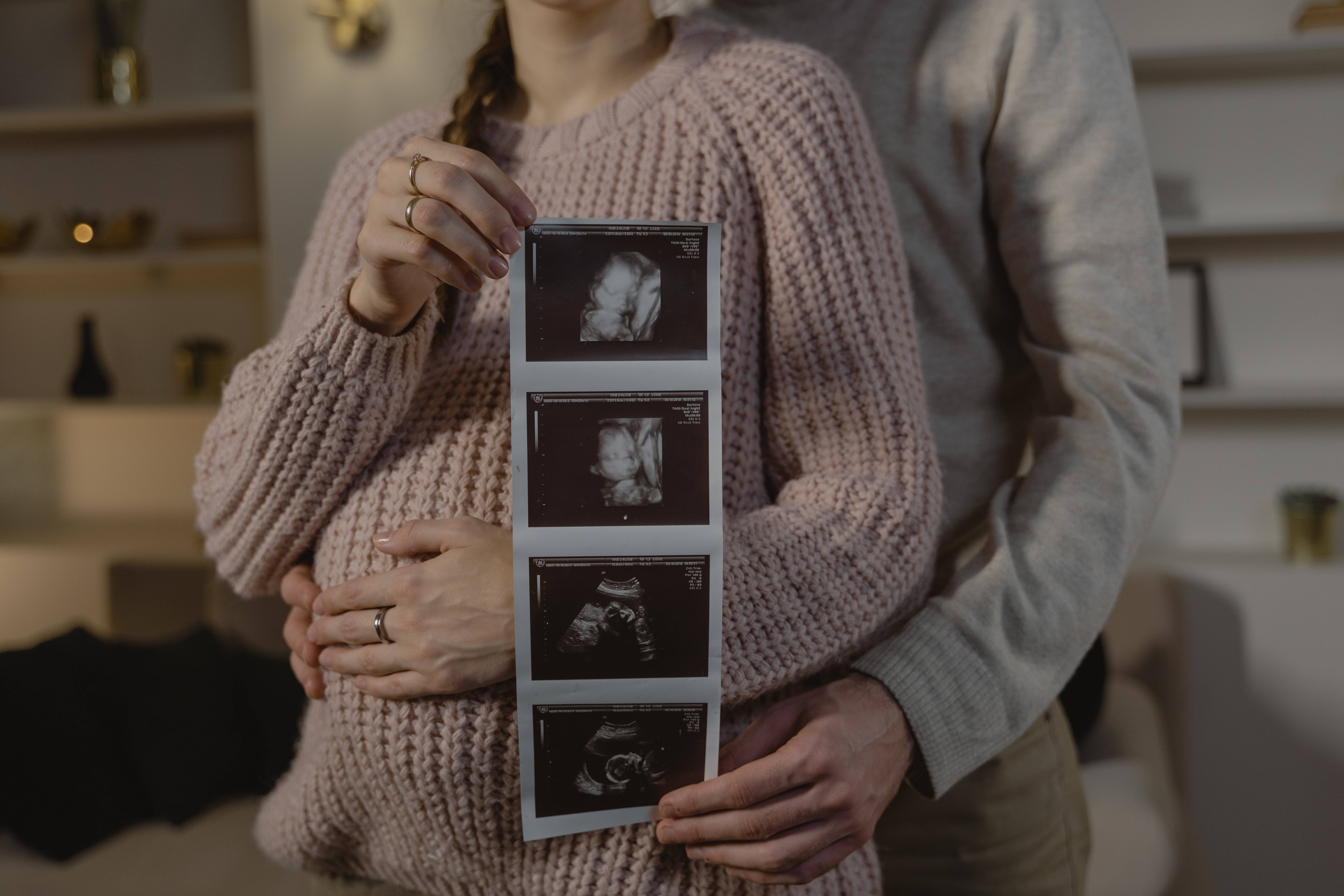 Couple Hands, ultrasound photo, unborn child, 5K Desktop Wallpaper