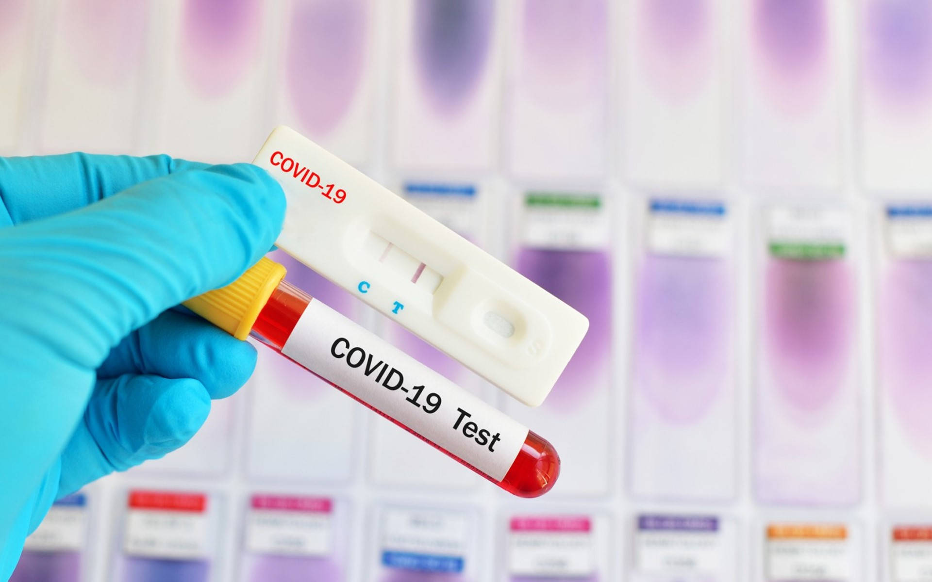 Covid Test, red vial, COVID-19 test tube, Full HD Desktop Wallpaper