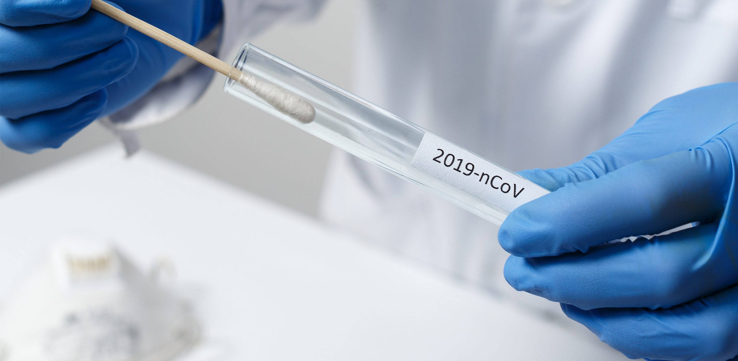 2019-nCoV, test tube, lab bench, 2K Desktop Wallpaper