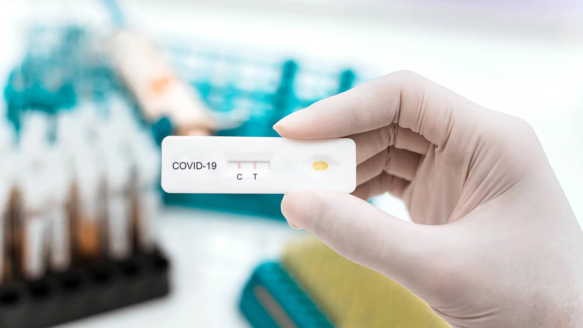 positive COVID-19 test strip, control line, test line, Full HD Desktop Wallpaper