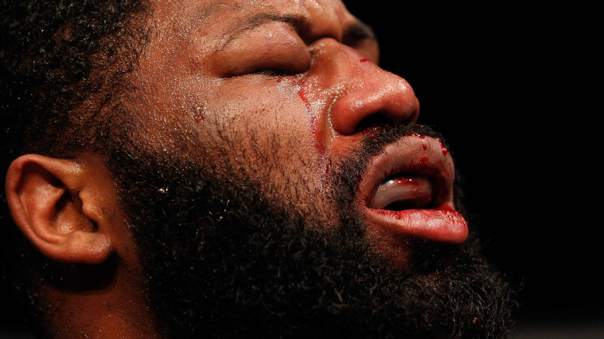 Curtis Blaydes, swollen eyes, blood streaming from nose and lip, Full HD Desktop Wallpaper