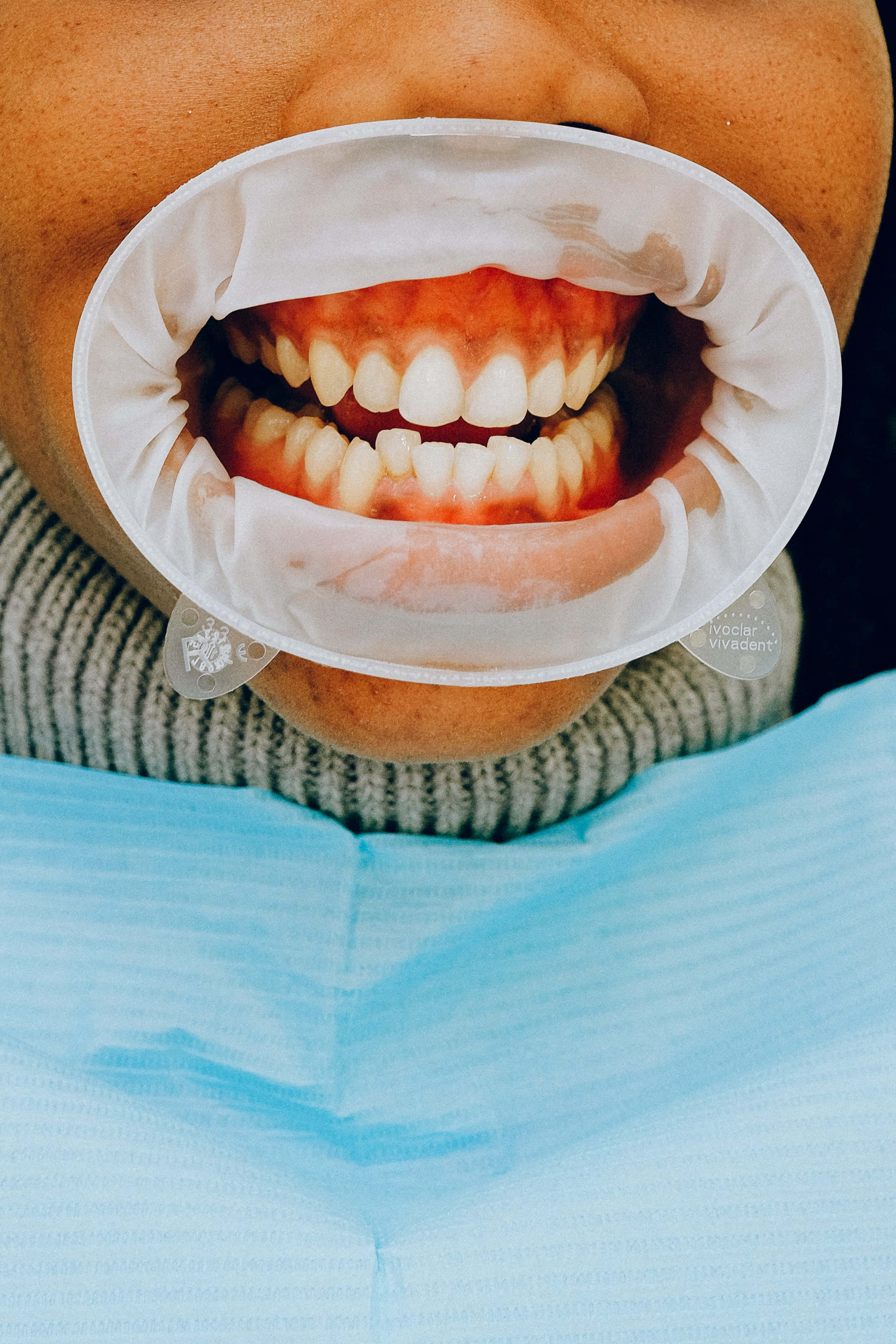 oral surgery, white protective barrier, blue dental bib, 2K Phone Wallpaper