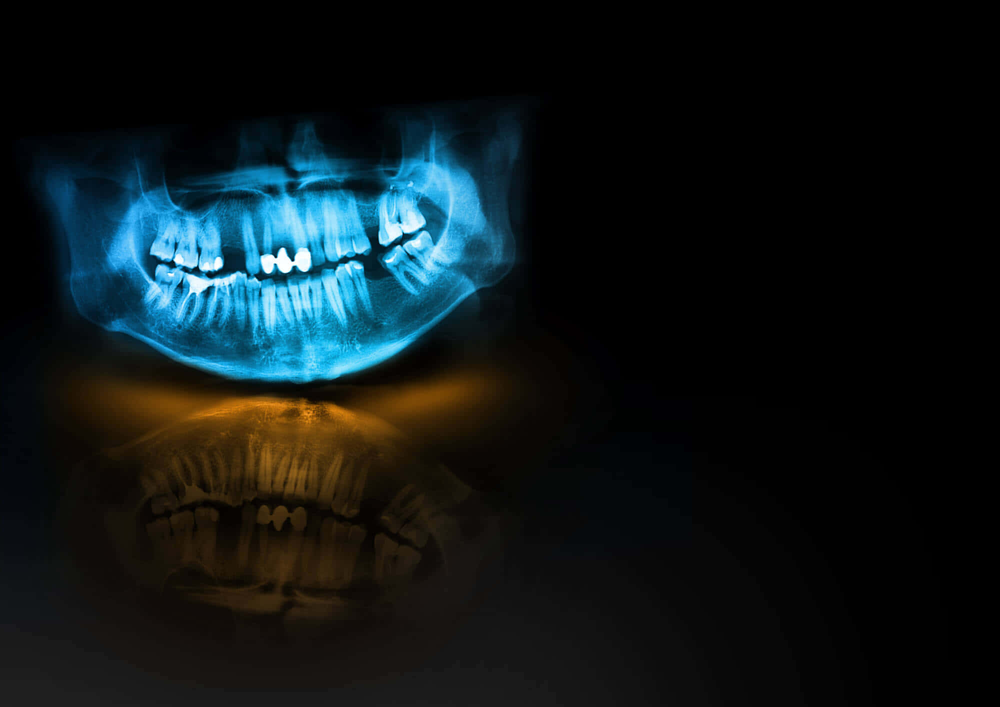 oral mouth x ray, glowing blue dental x-ray, human jaw, Full HD Desktop Wallpaper