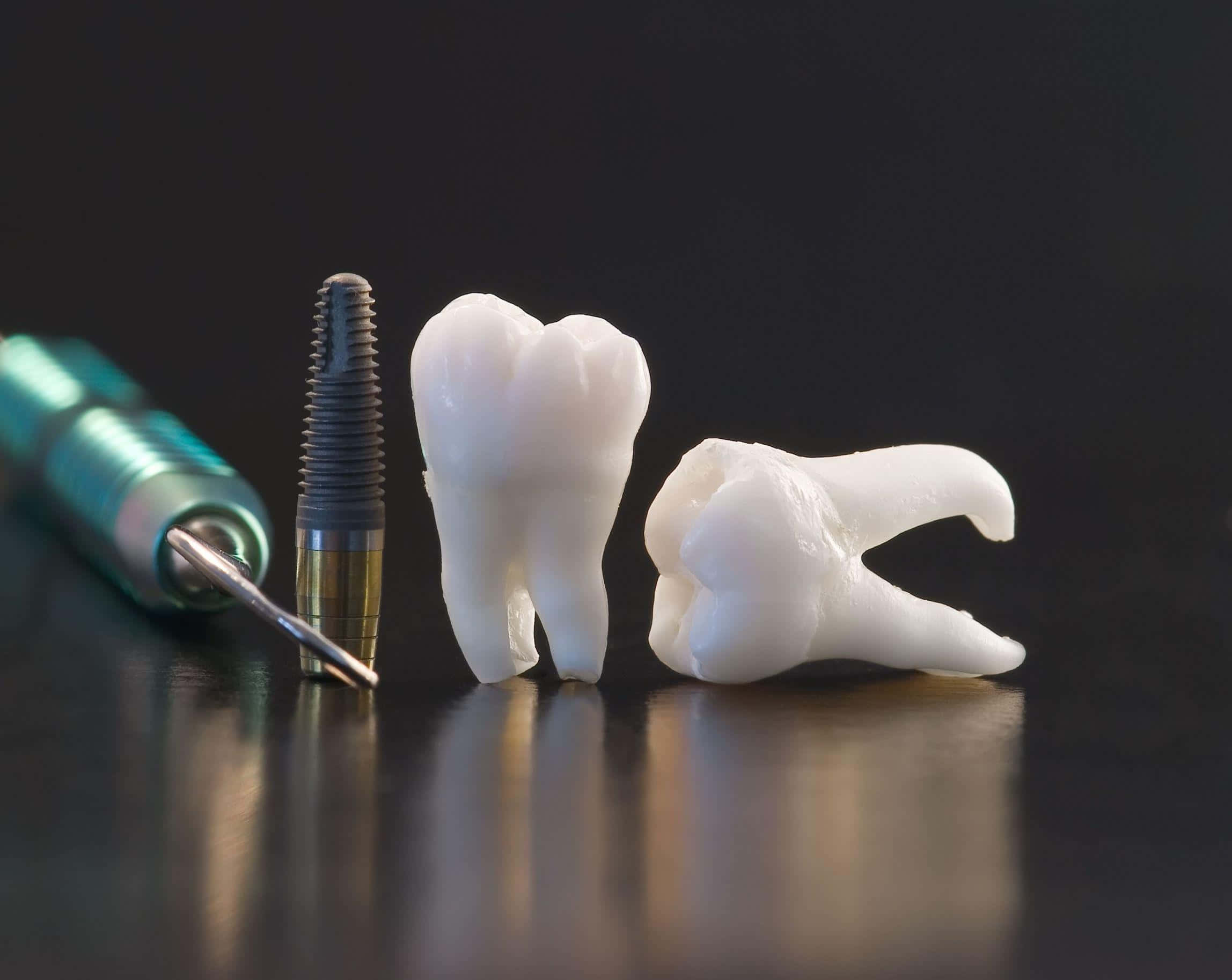 dental implants, teeth models, tooth implant, Full HD Desktop Wallpaper