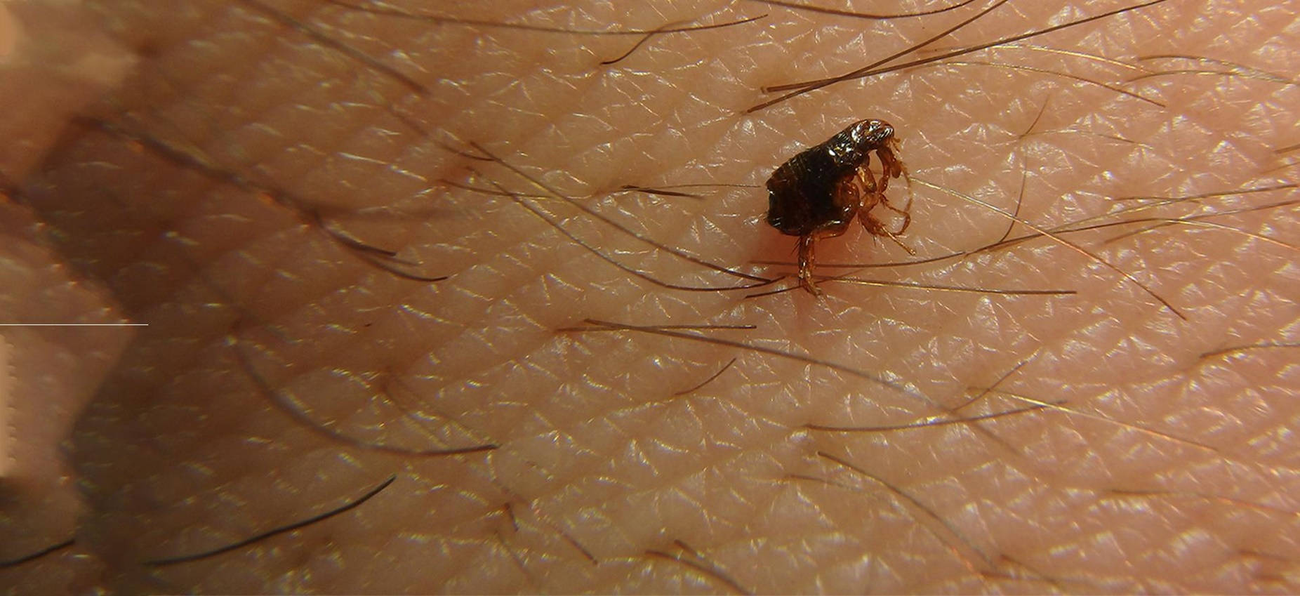 flea, human skin, hairs, HD Desktop Wallpaper