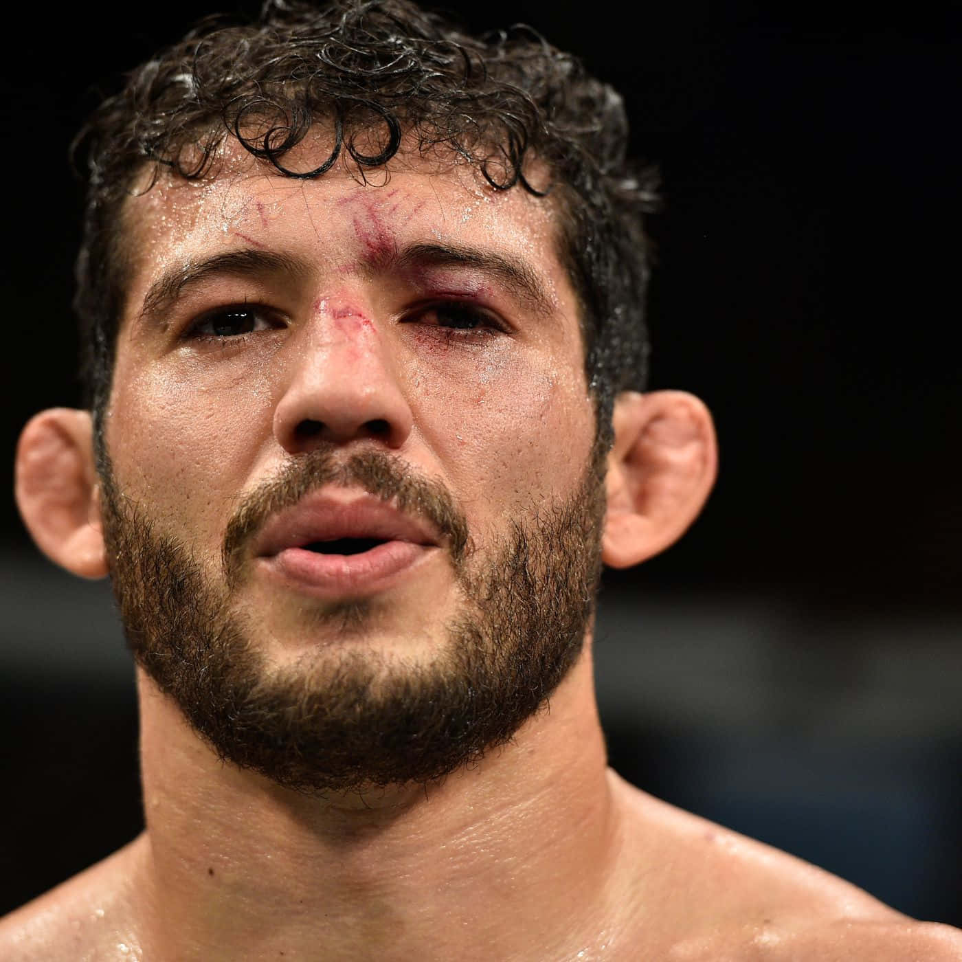 Gilbert Melendez, left eye injury, sweaty fighter, HD Desktop Wallpaper