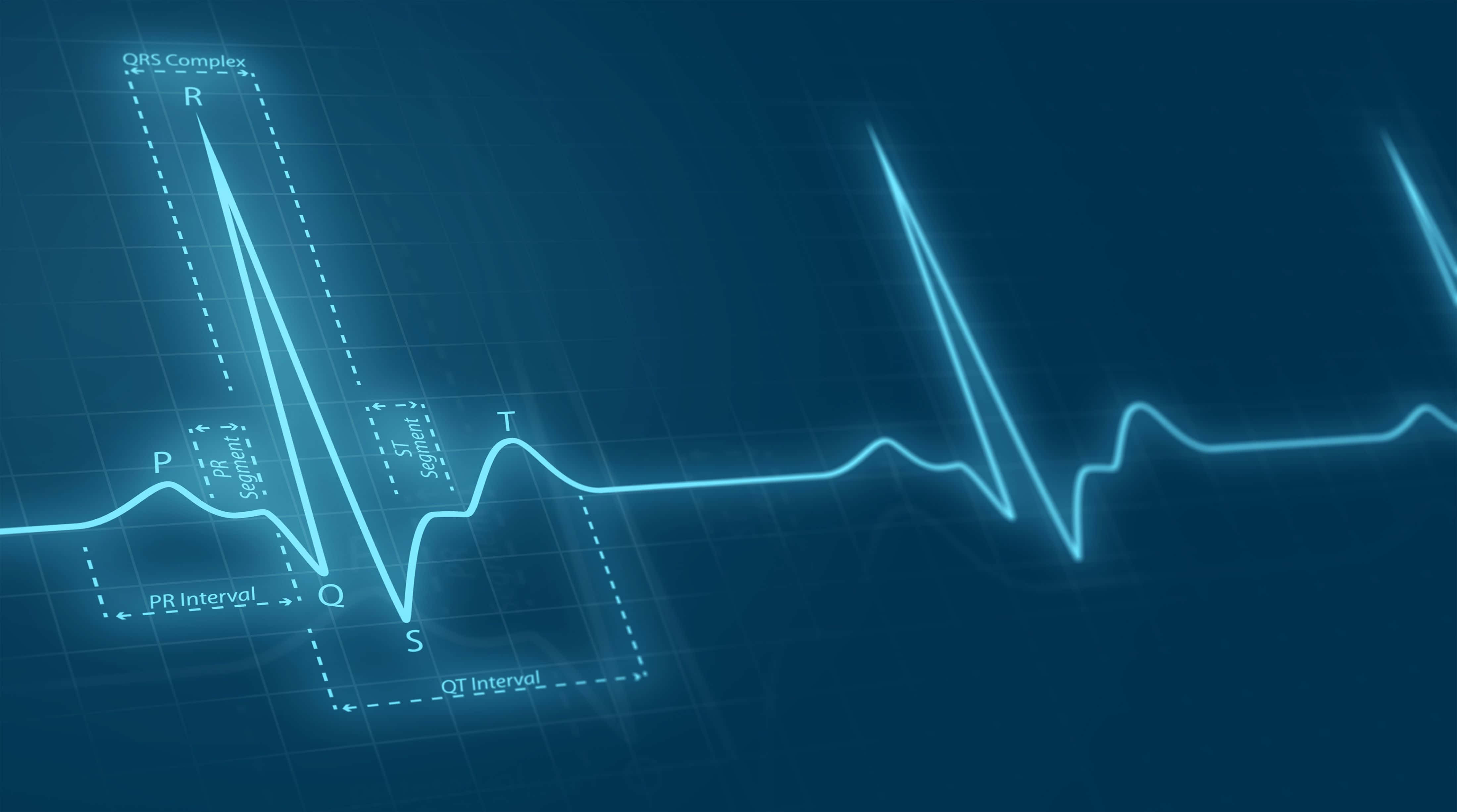 glowing blue electrocardiogram waveform, labeled peaks and intervals, dark grid background, 4K Desktop Wallpaper