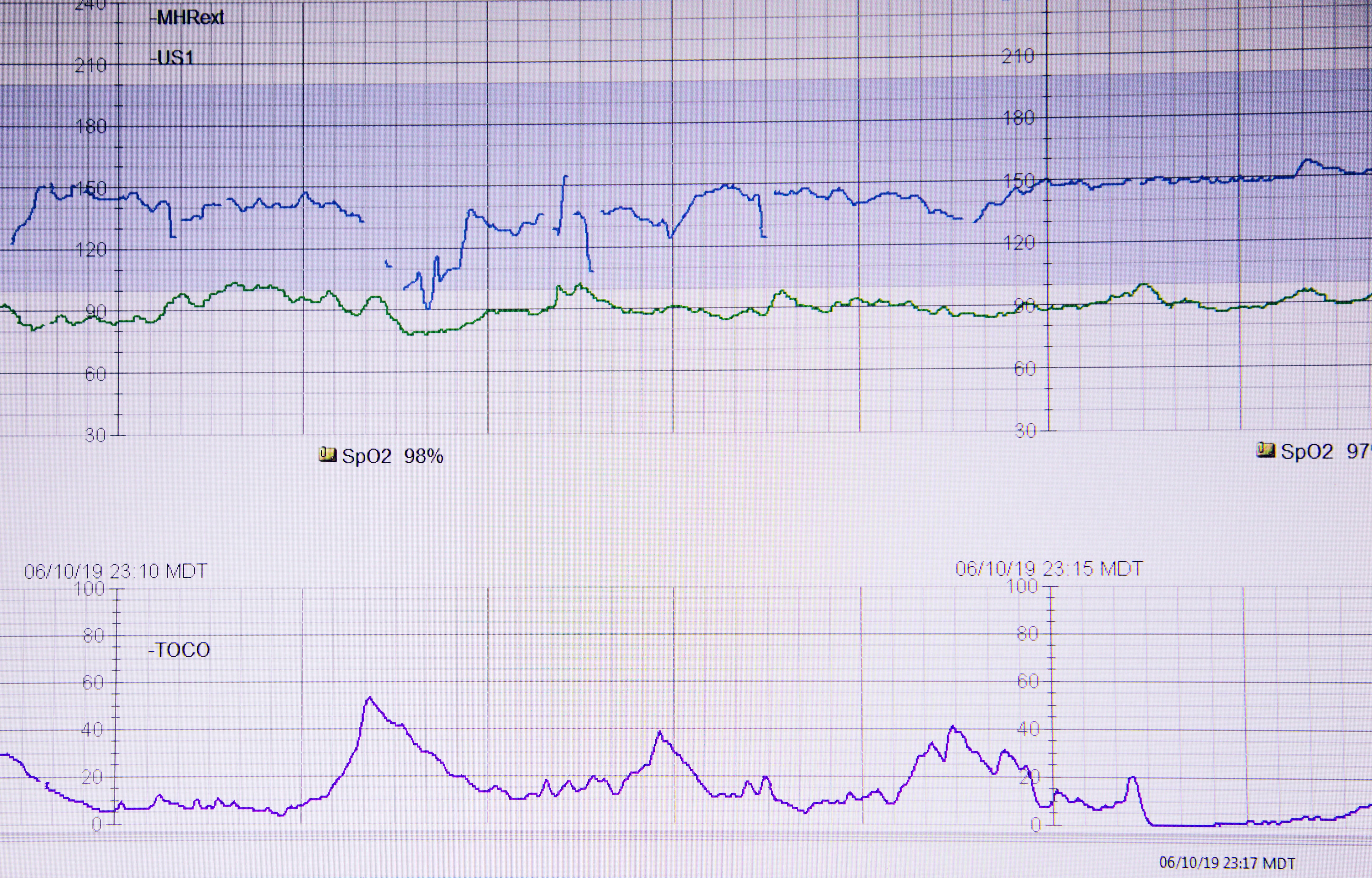 fetal heartbeat monitor, blue green, purple, 5K Desktop Wallpaper