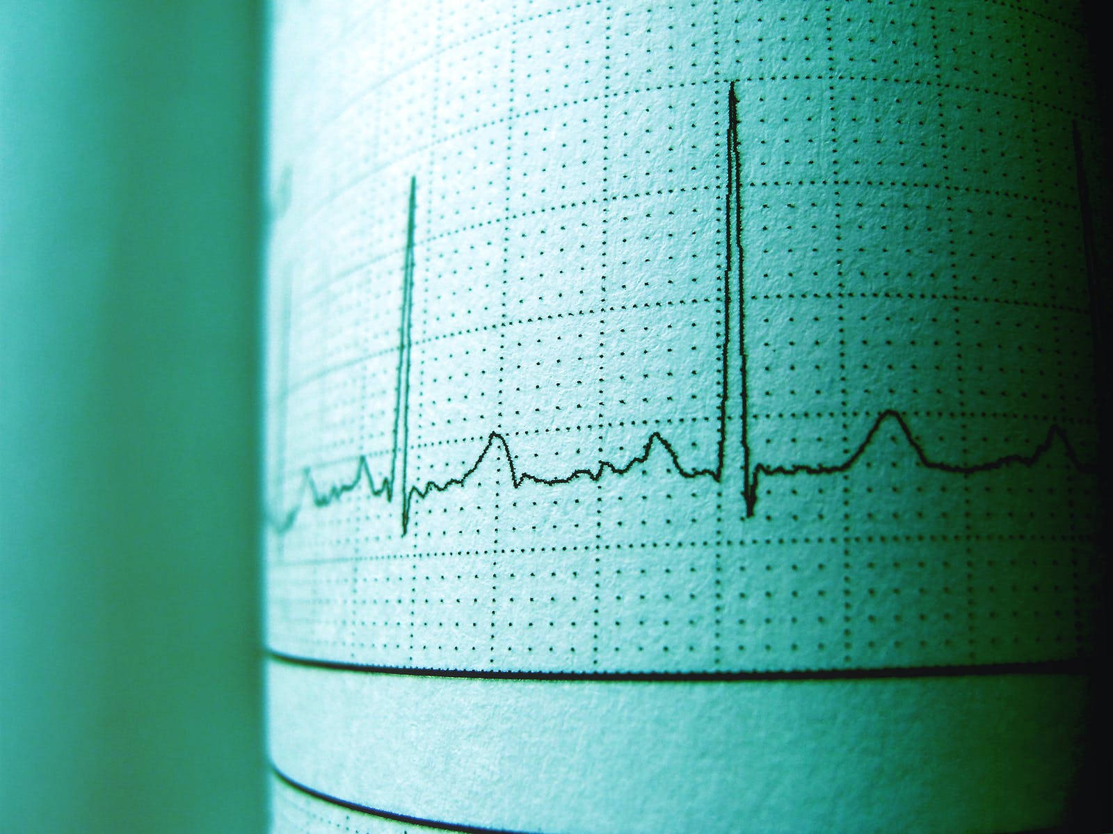Heartbeat, cardiogram, teal-tinted, HD Desktop Wallpaper