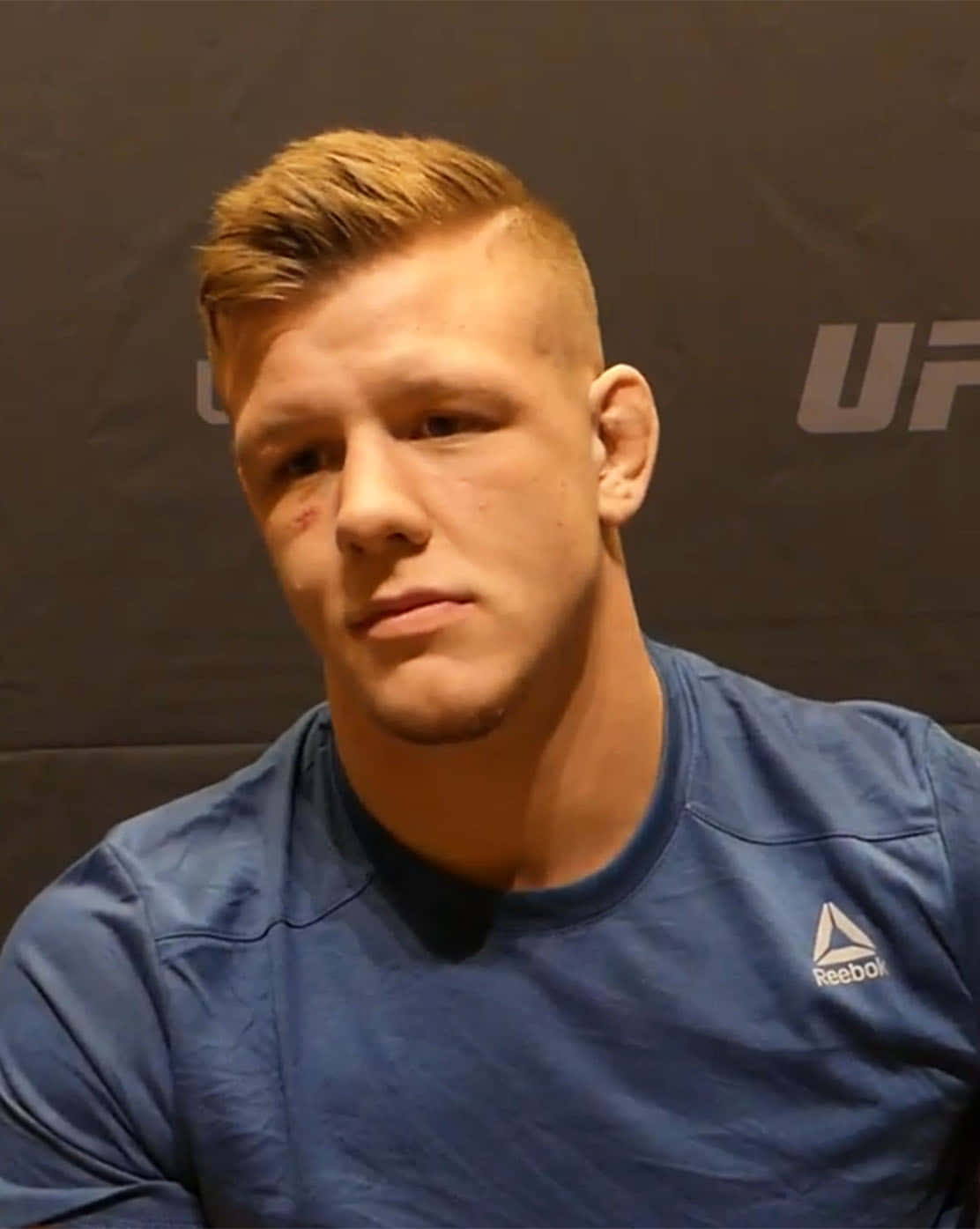 Jimmy Crute, blue Reebok shirt, faded bruise on his cheek, HD Phone Wallpaper