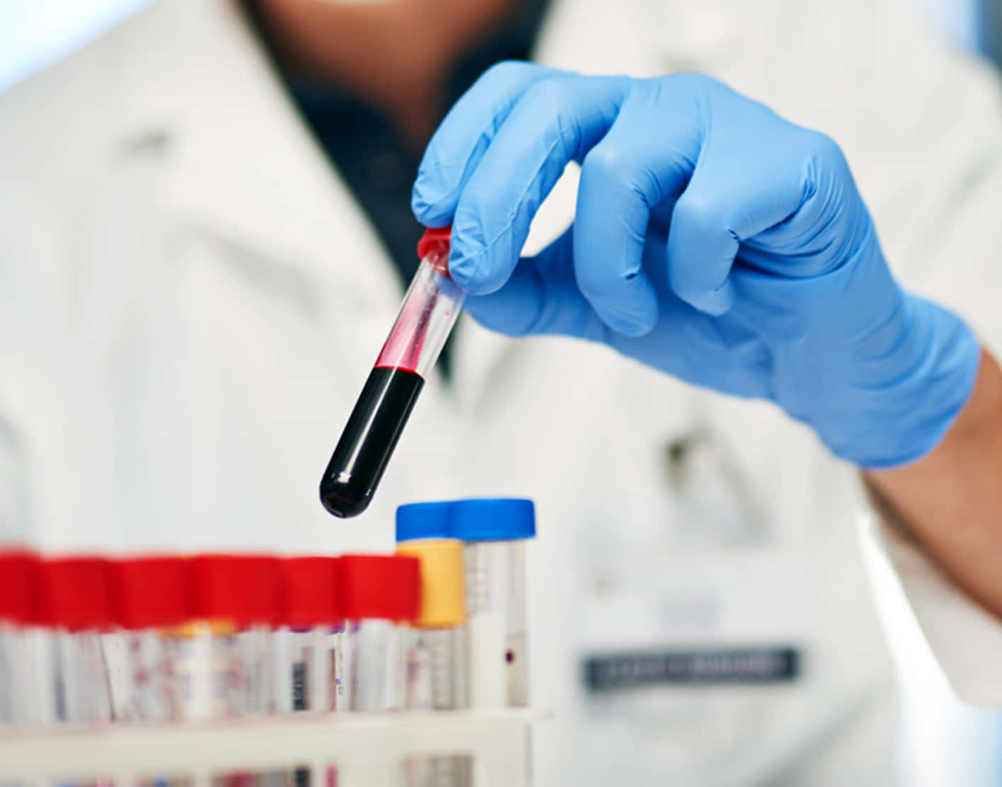 laboratory, blood-filled testing tube, gloved hand, HD Desktop Wallpaper