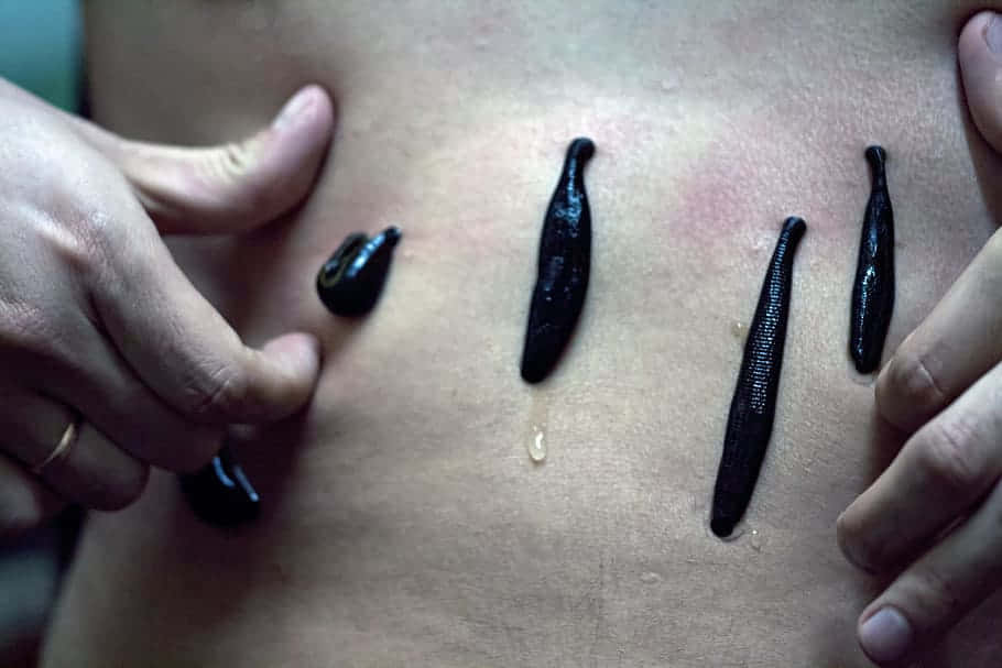 leeches, human skin, bare skin, SD Desktop Wallpaper