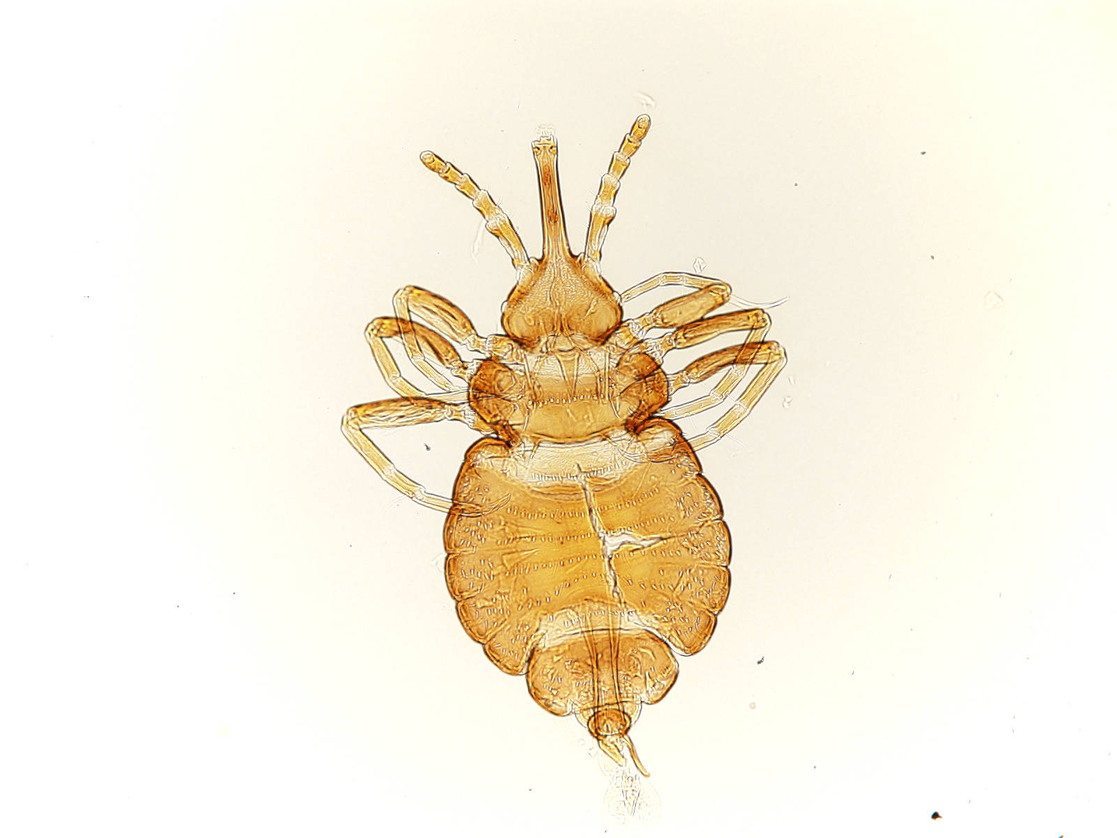 louse, microscope, translucent amber-colored, HD Desktop Wallpaper