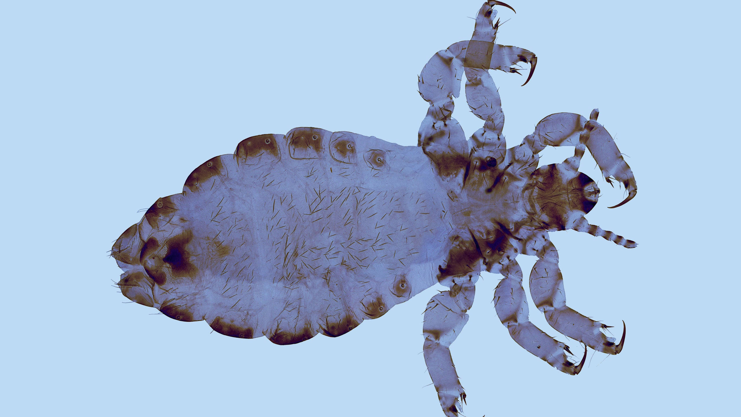 white louse, microscopic view, segmented body, 2K Desktop Wallpaper