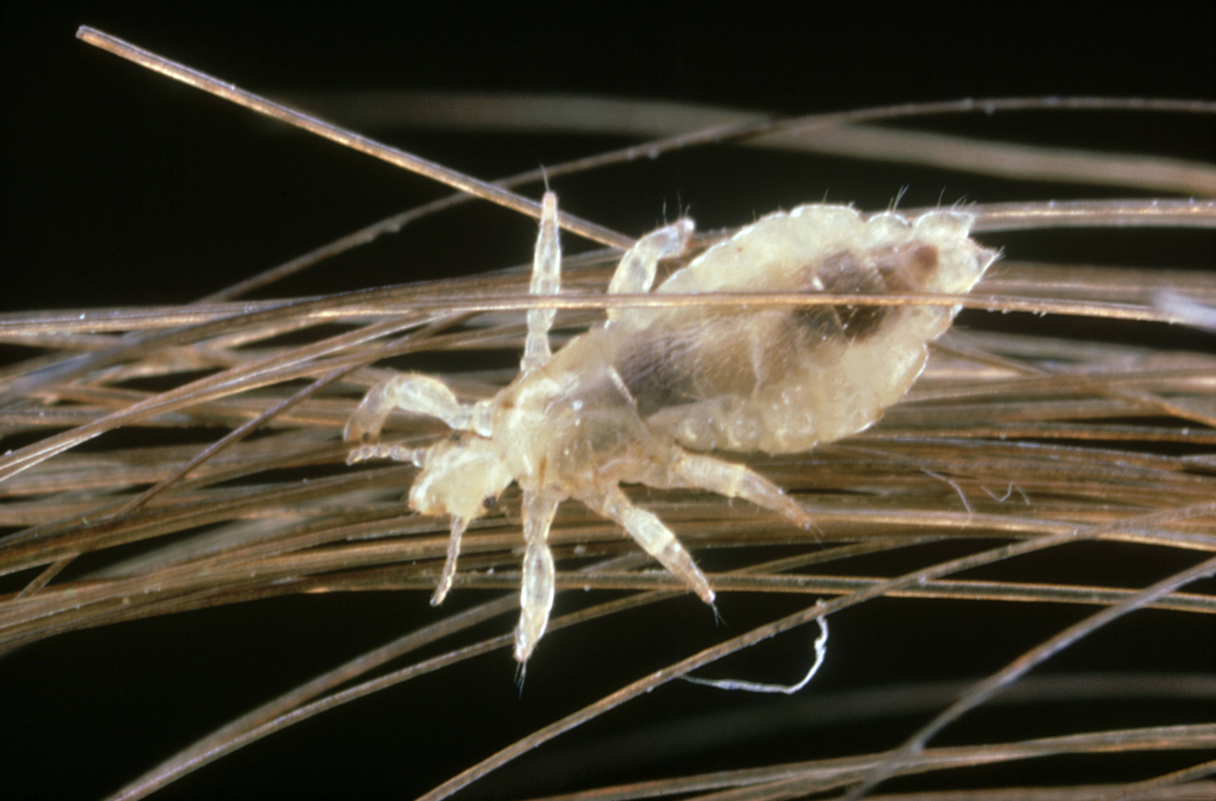 head louse, translucent, human hair strands, 4K Desktop Wallpaper