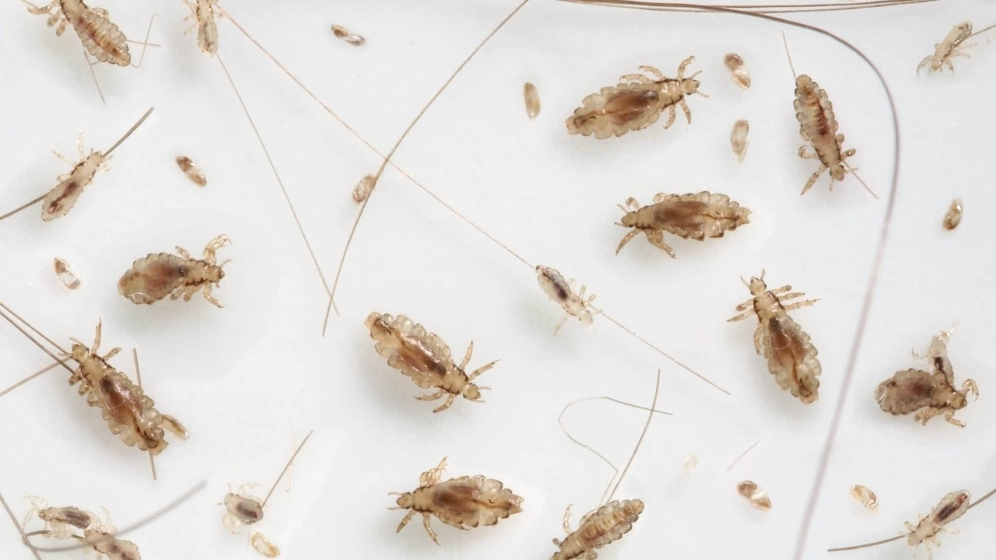 louse, hair strands, plain white surface, Full HD Desktop Wallpaper