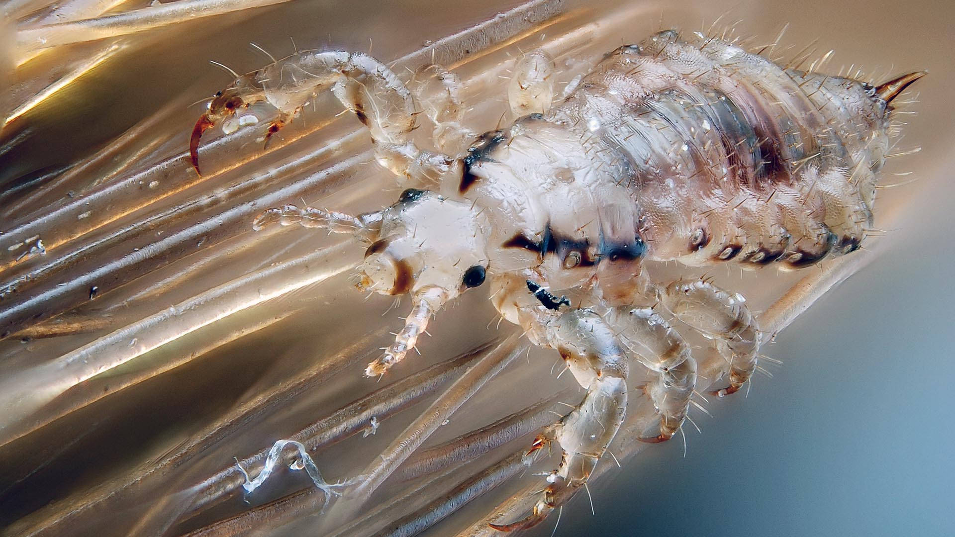 translucent body louse, macro photograph, human hair strands, Full HD Desktop Wallpaper
