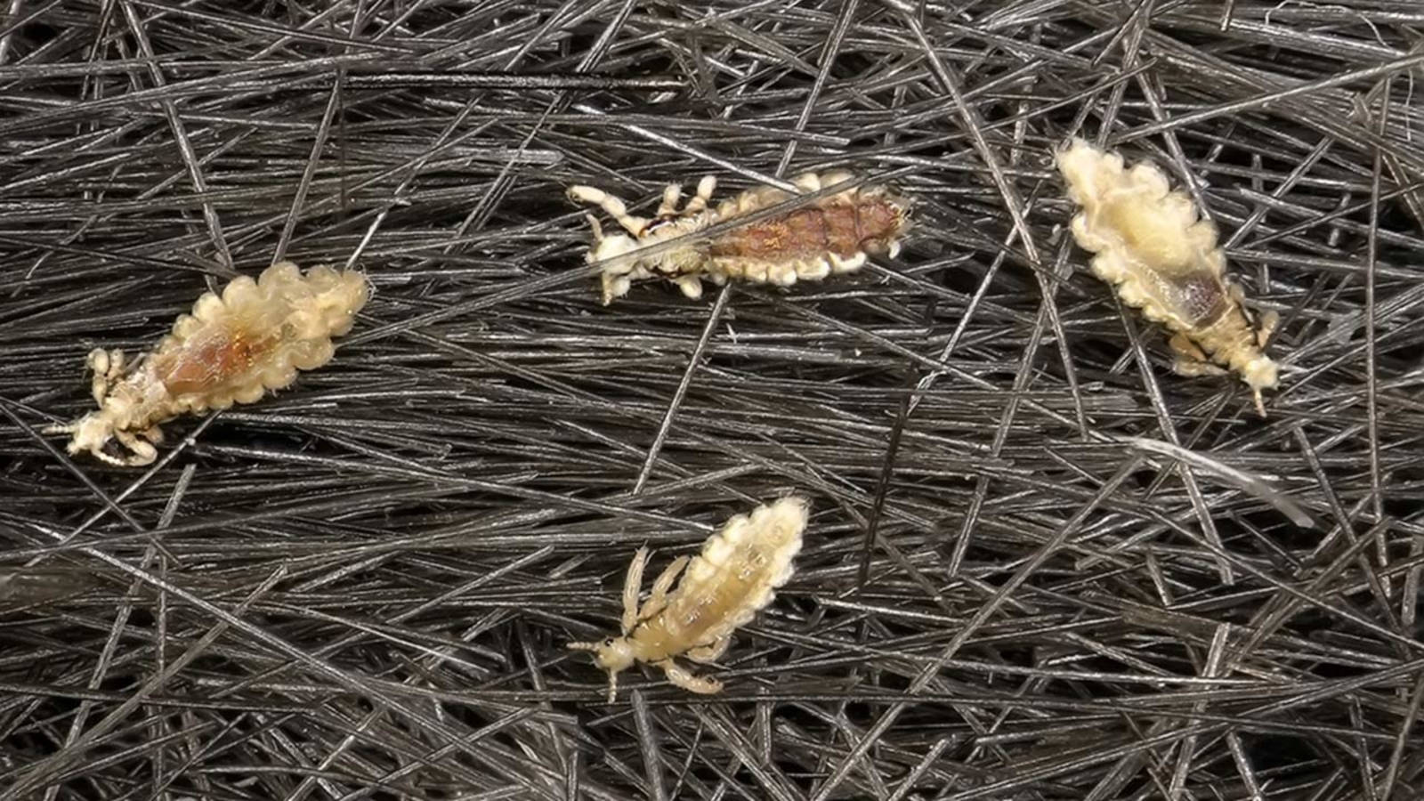 body louse, haystack, dark human hair strands, HD Desktop Wallpaper