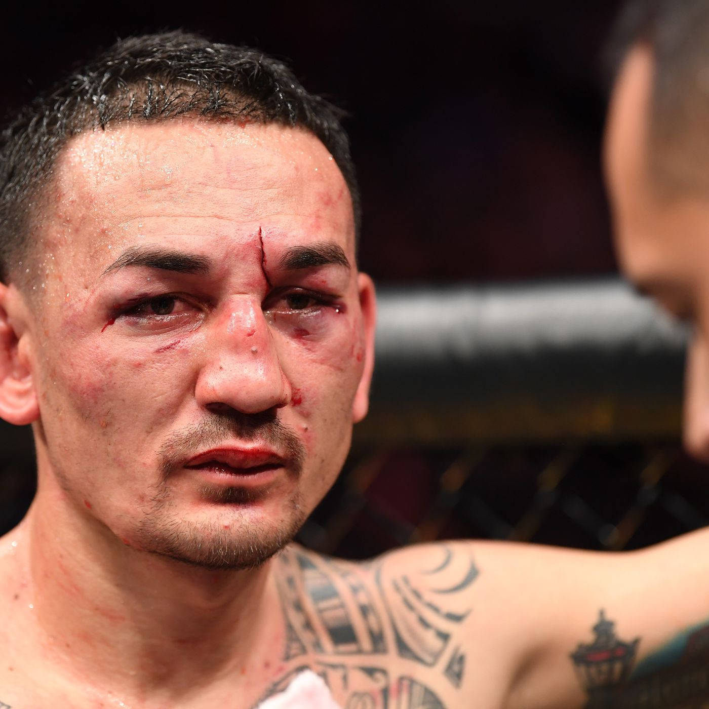 Max Holloway, bloody cut face, cage, HD Desktop Wallpaper