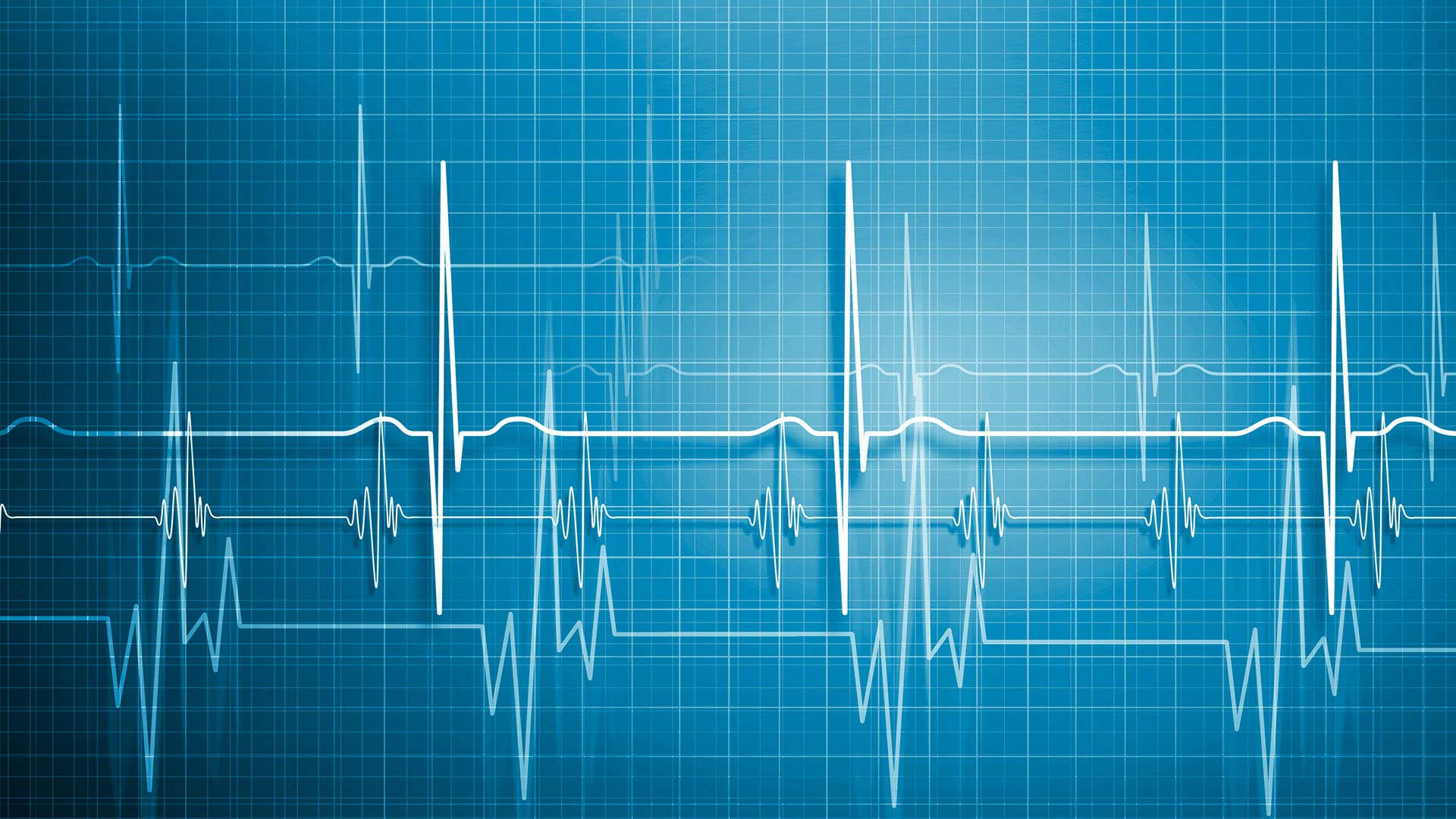 MBBS, Normal Heartbeat Chart, electrocardiogram lines, Full HD Desktop Wallpaper