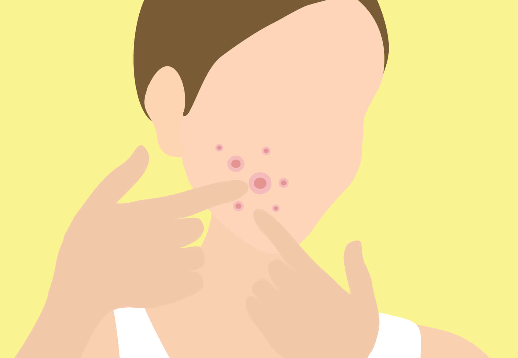 Popping Pimples Outline, pink acne blemishes, pale yellow background, HD Desktop Wallpaper
