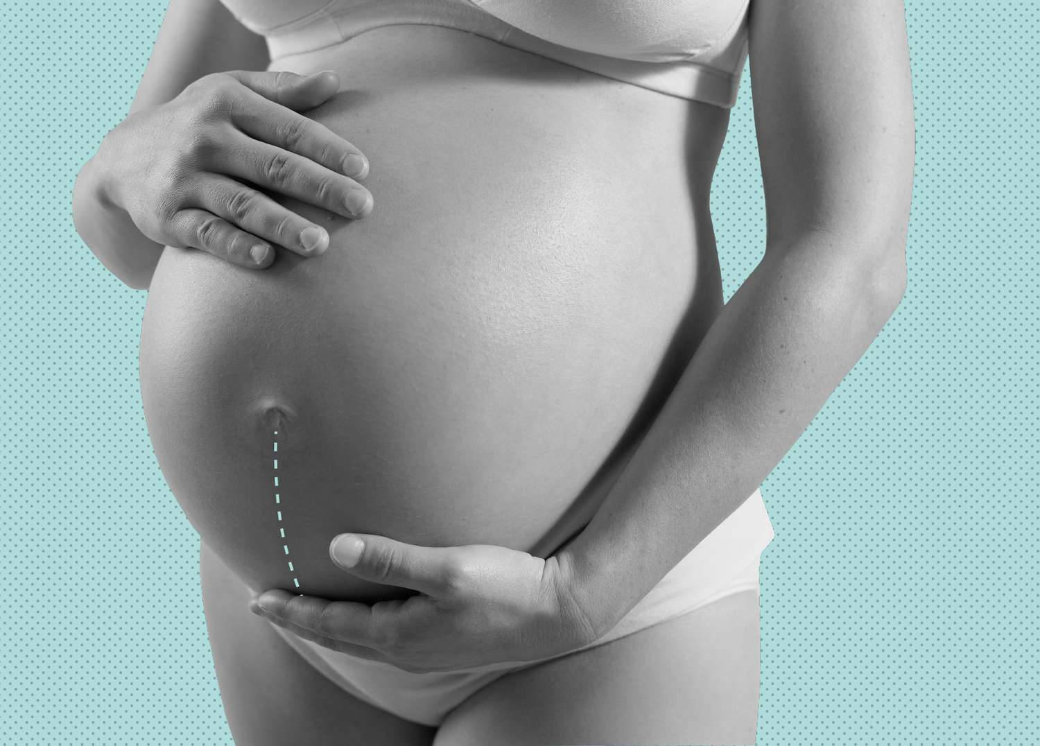 pregnant belly, teal dotted background, surgical scar, HD Desktop Wallpaper